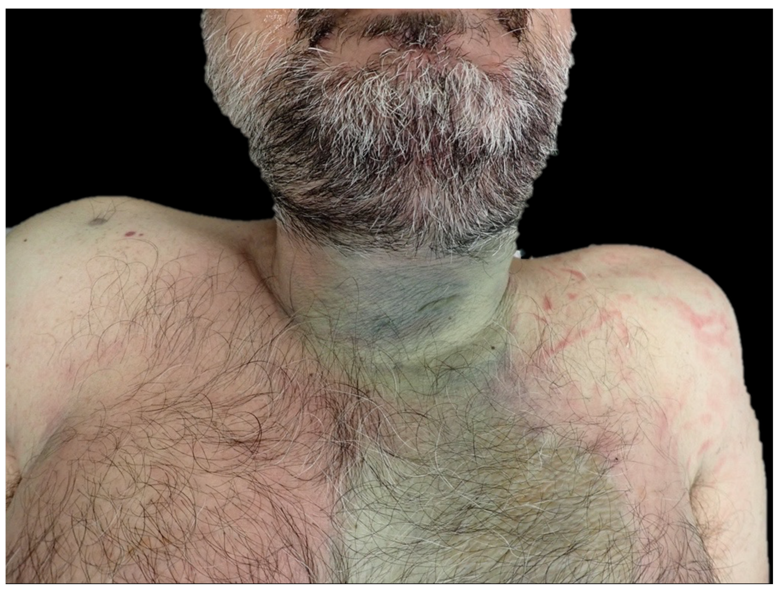 Diagnostics 14 01150 g002