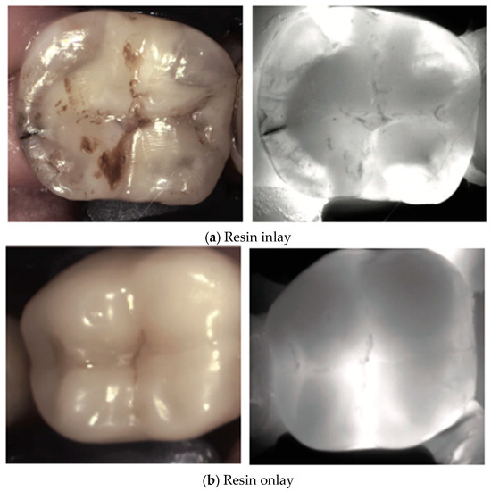 Diagnostics 14 01154 g005