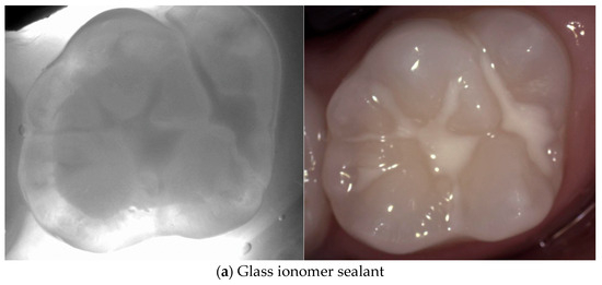 Diagnostics 14 01154 g006a