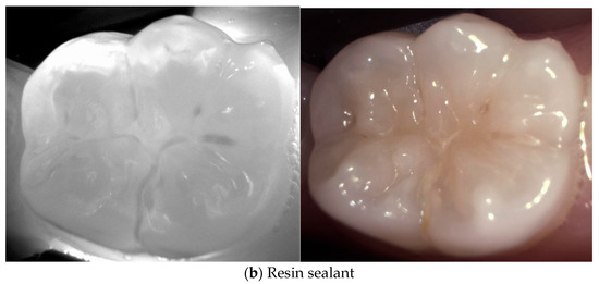 Diagnostics 14 01154 g006b