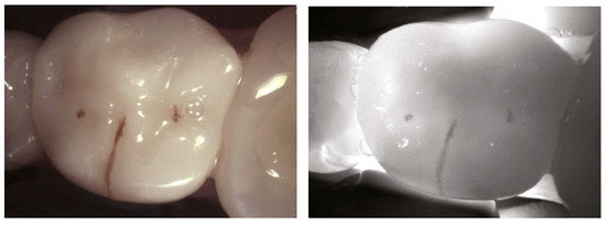 Diagnostics 14 01154 g008