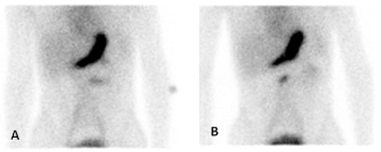 Diagnostics 14 01162 g001