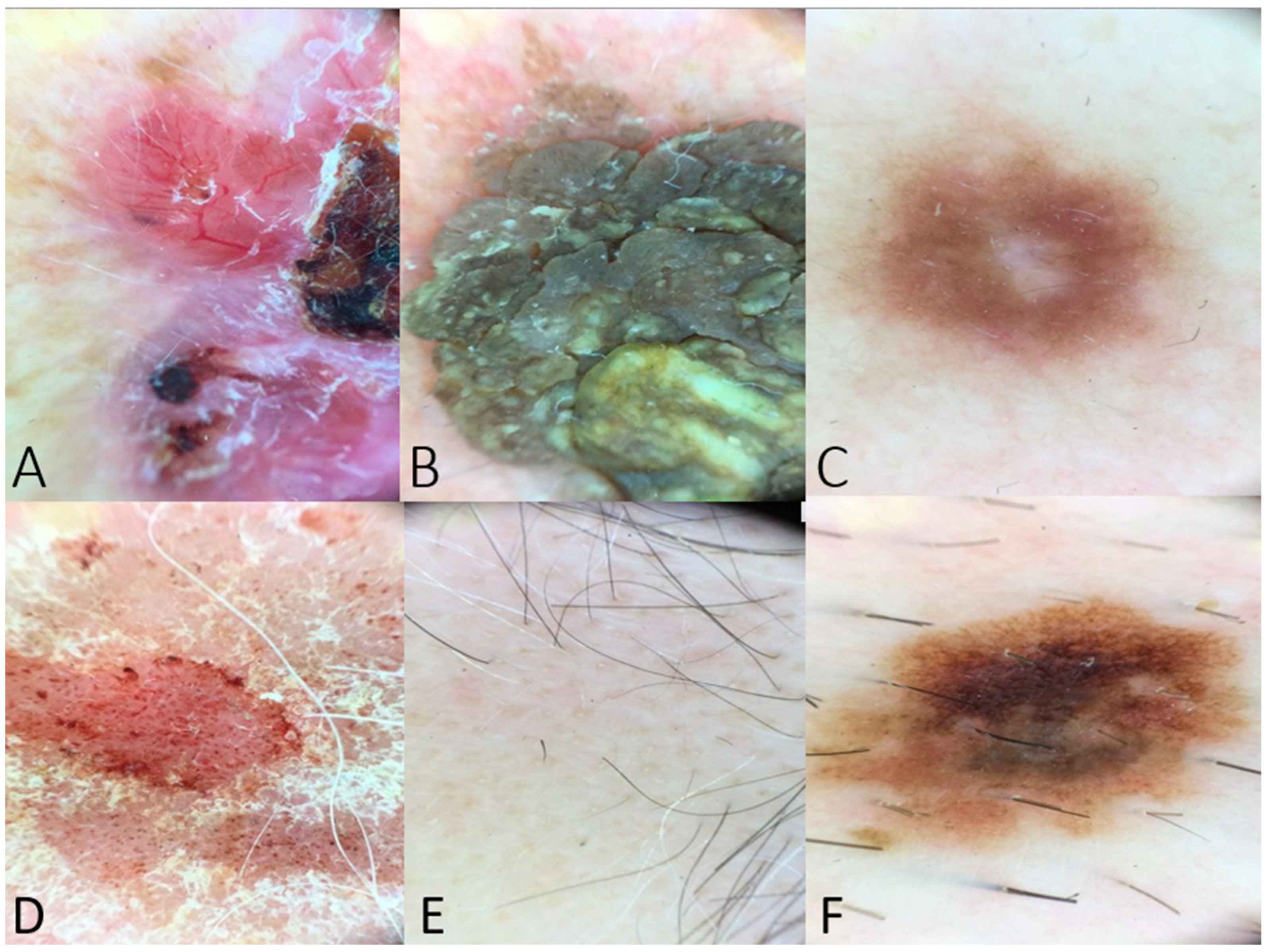 Diagnostics 14 01165 g001