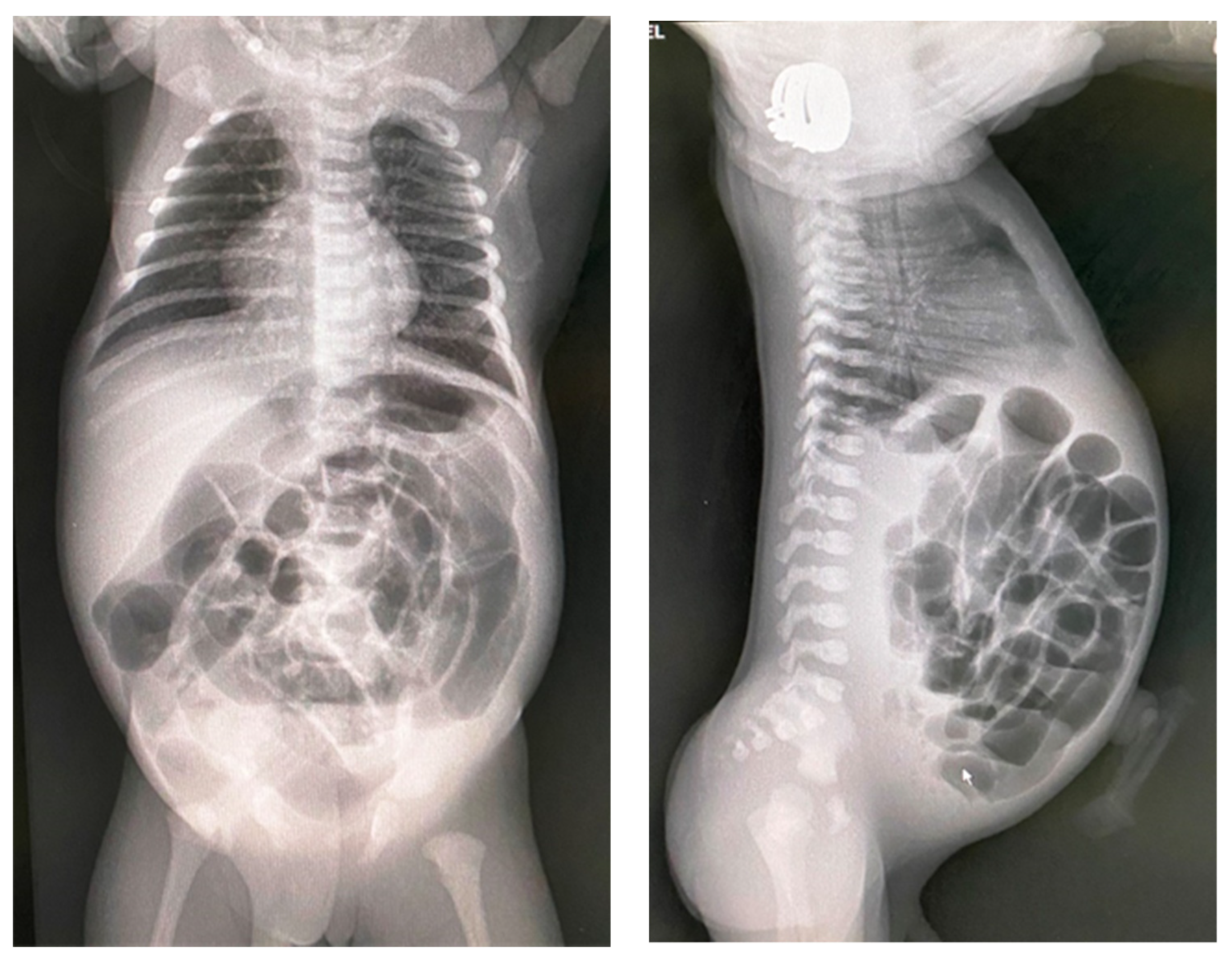 Diagnostics 14 01179 g003 Diagnostics 14 01179 g003