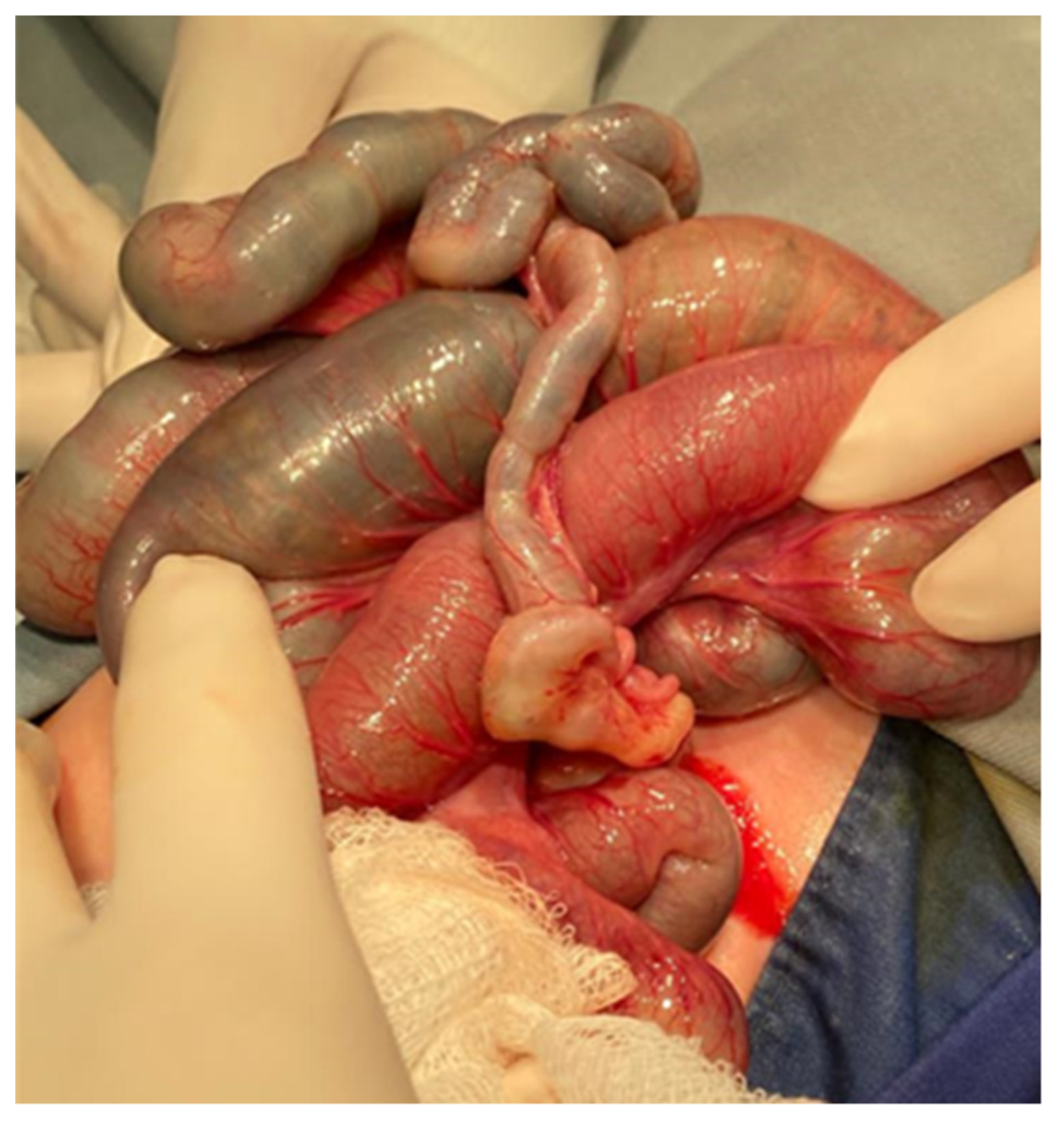 Diagnostics 14 01179 g004 Diagnostics 14 01179 g004