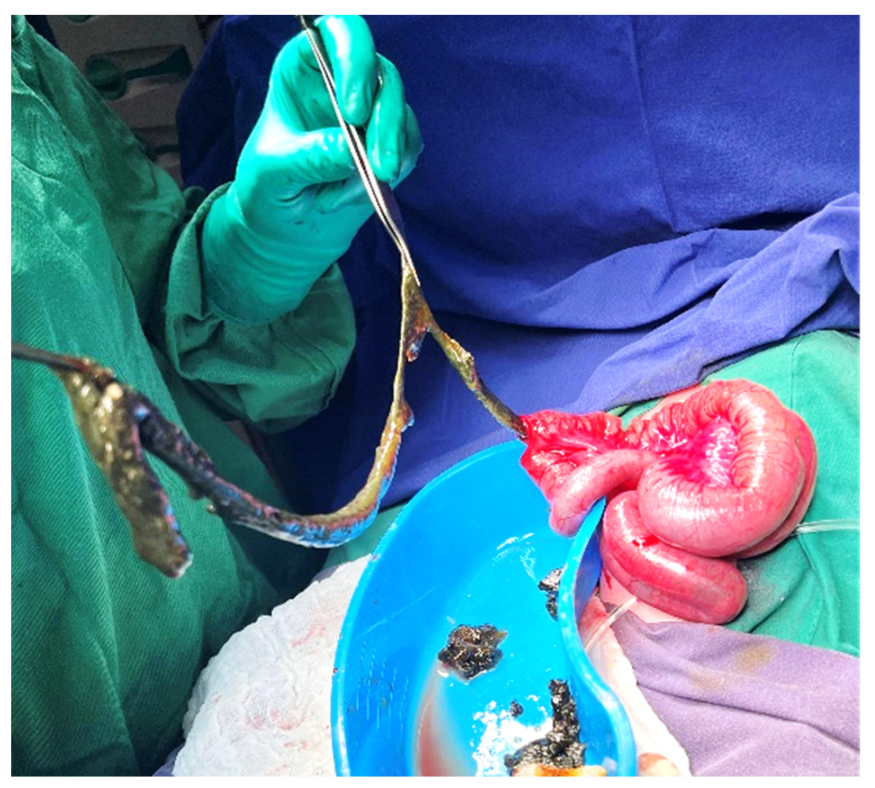 Diagnostics 14 01179 g005 Diagnostics 14 01179 g005