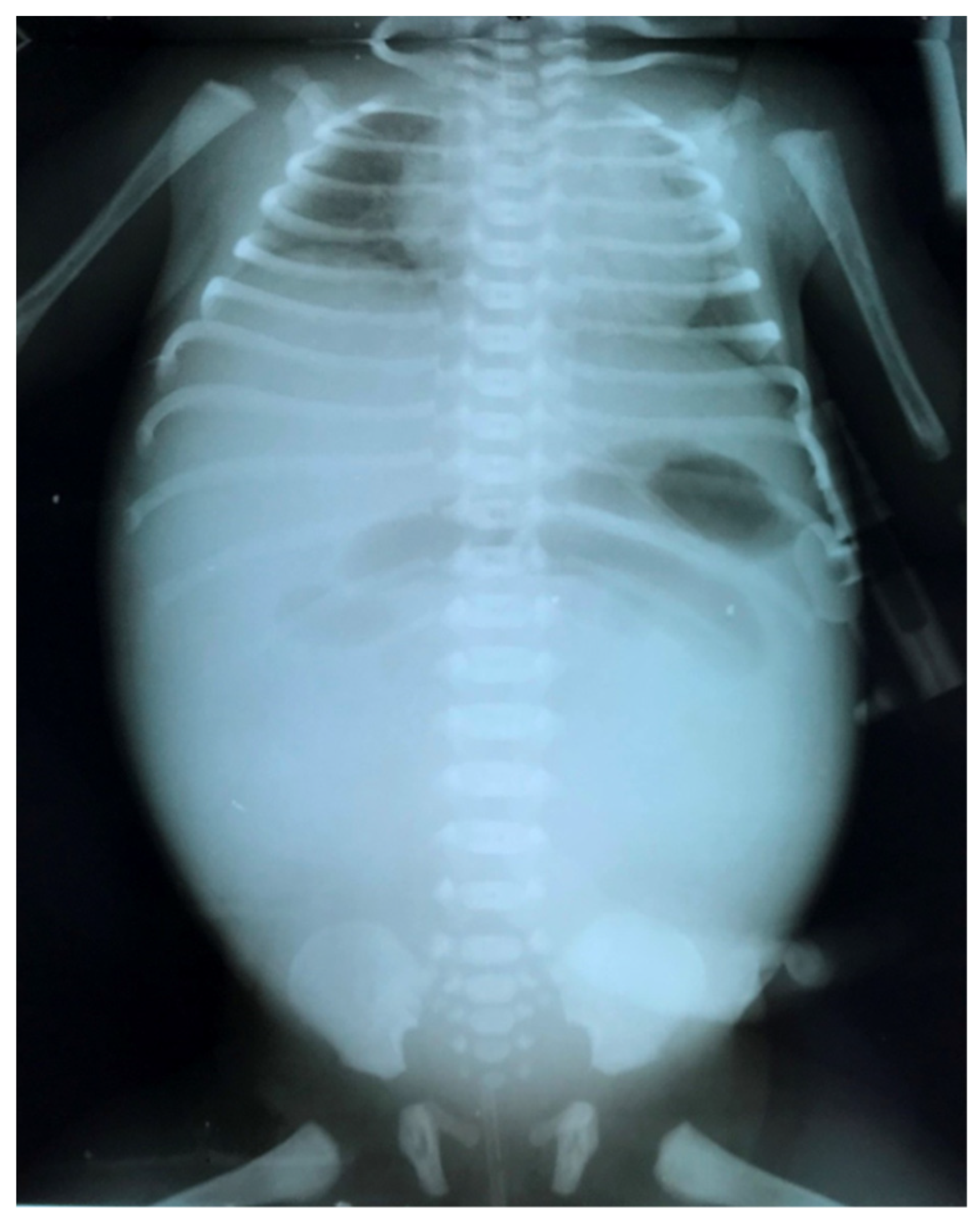 Diagnostics 14 01179 g007 Diagnostics 14 01179 g007