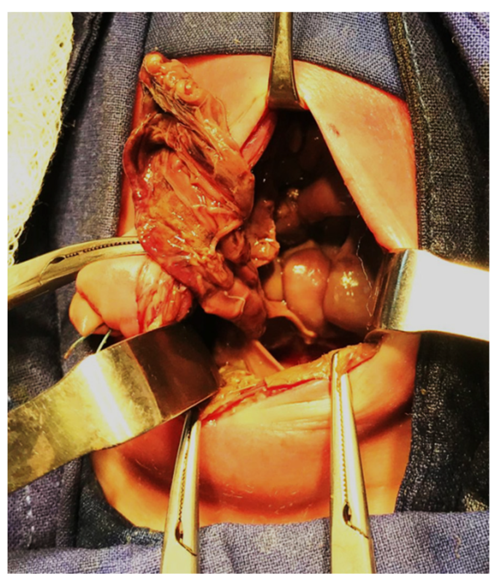 Diagnostics 14 01179 g008 Diagnostics 14 01179 g008