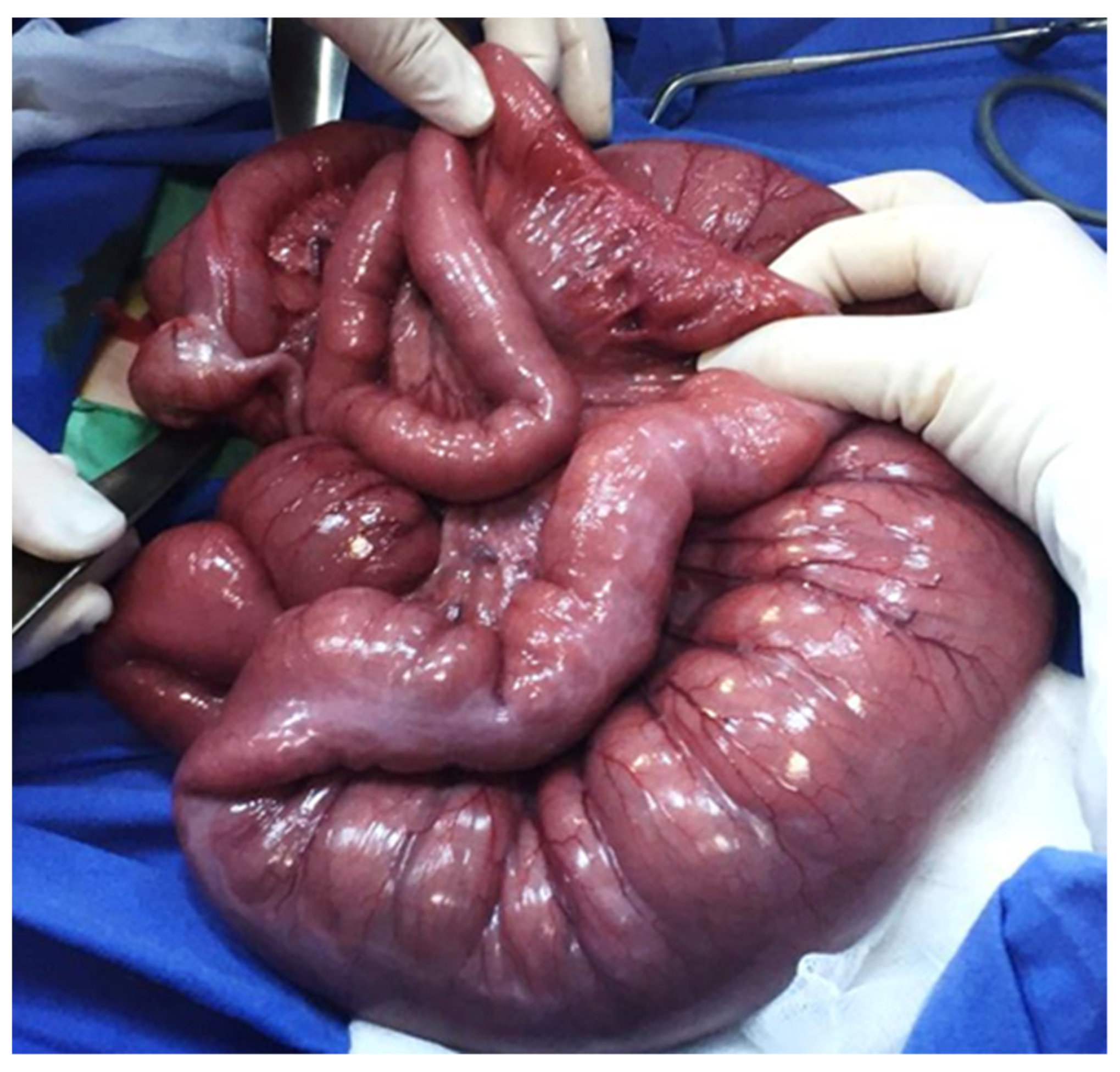 Diagnostics 14 01179 g009 Diagnostics 14 01179 g009