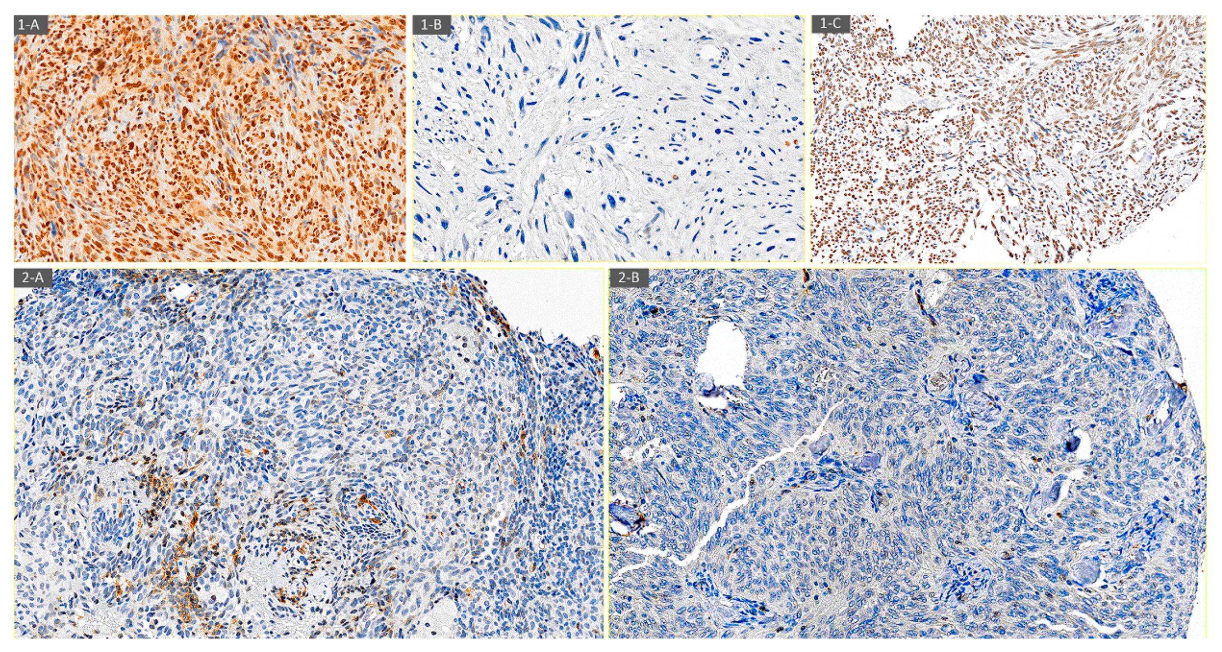 Diagnostics 14 01195 g001