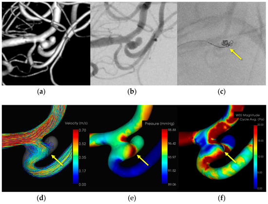 Diagnostics 14 01203 g003