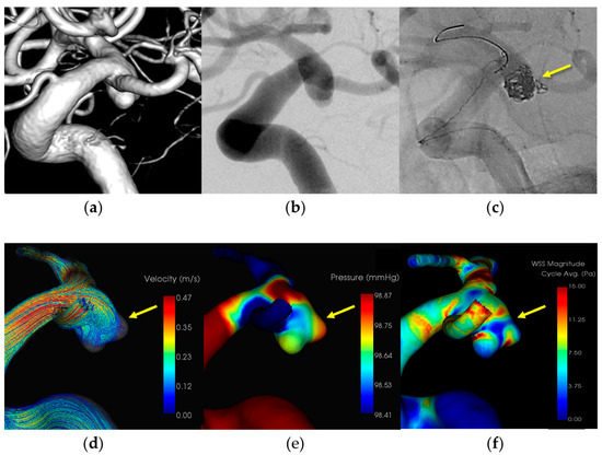 Diagnostics 14 01203 g004