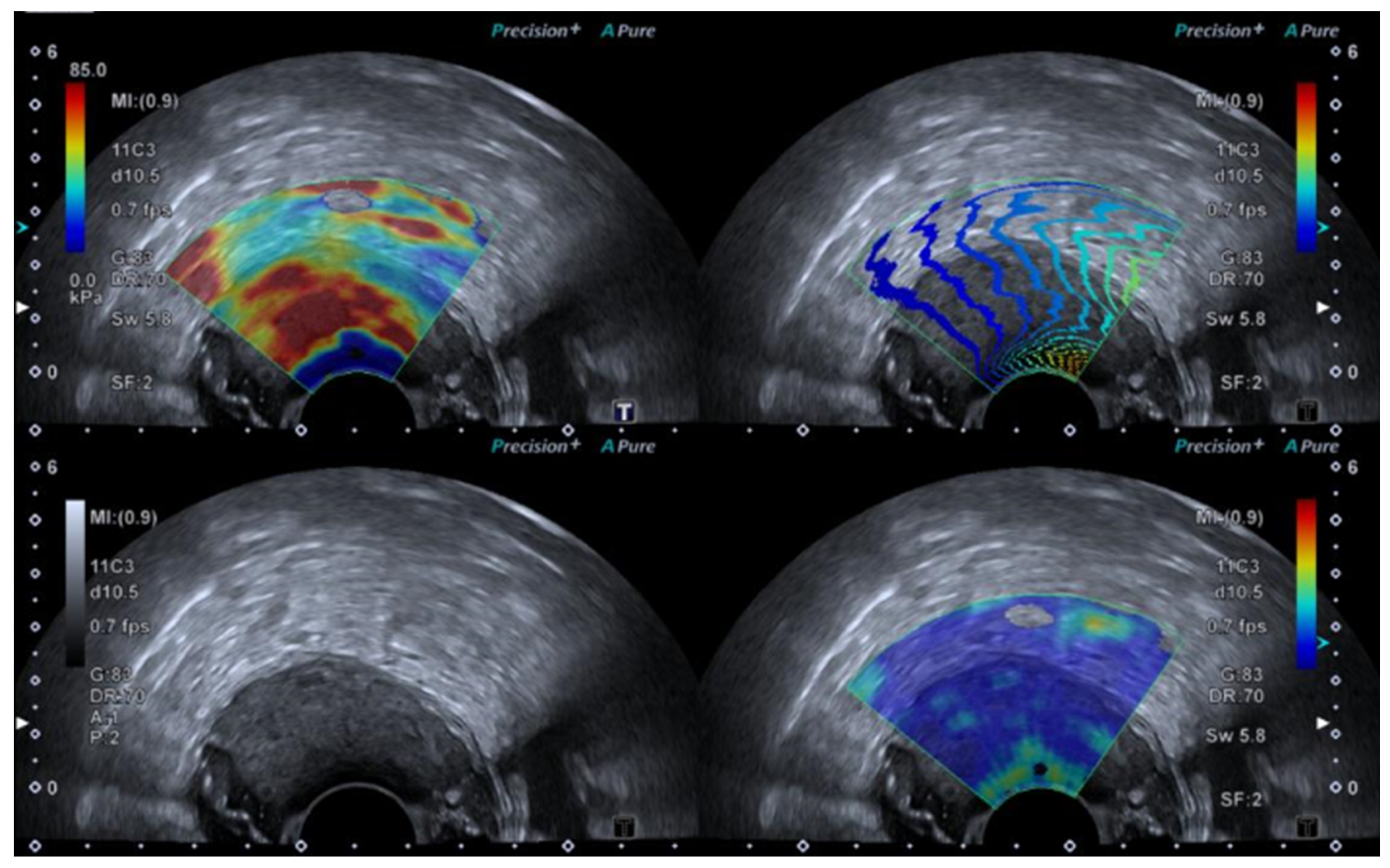 Diagnostics 14 01218 g001 Diagnostics 14 01218 g001