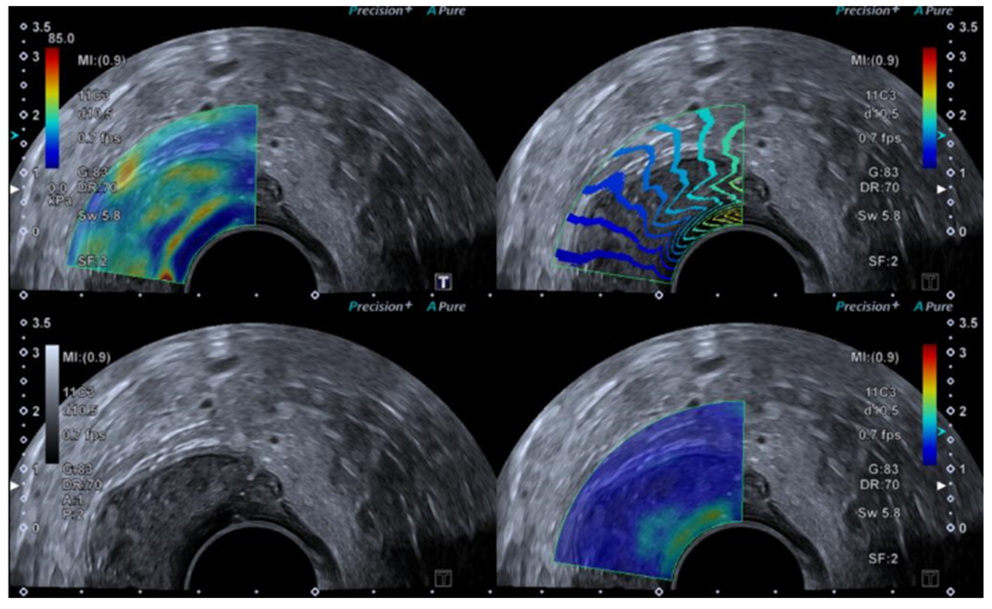 Diagnostics 14 01218 g003 Diagnostics 14 01218 g003