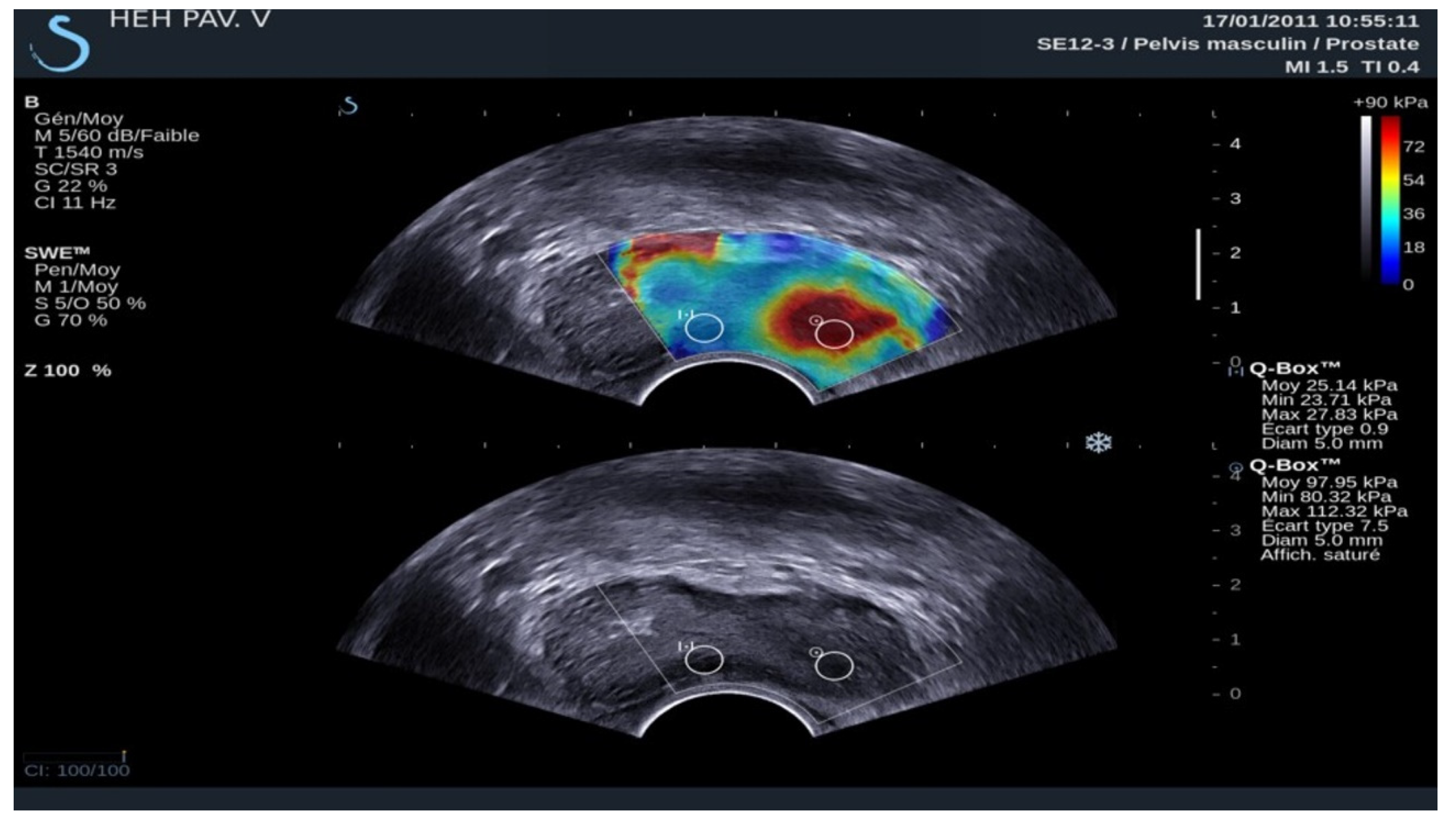 Diagnostics 14 01218 g004 Diagnostics 14 01218 g004