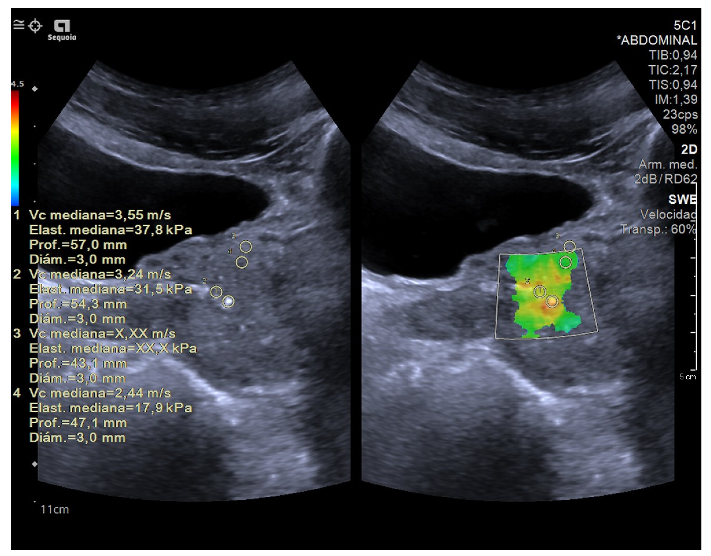 Diagnostics 14 01218 g005 Diagnostics 14 01218 g005
