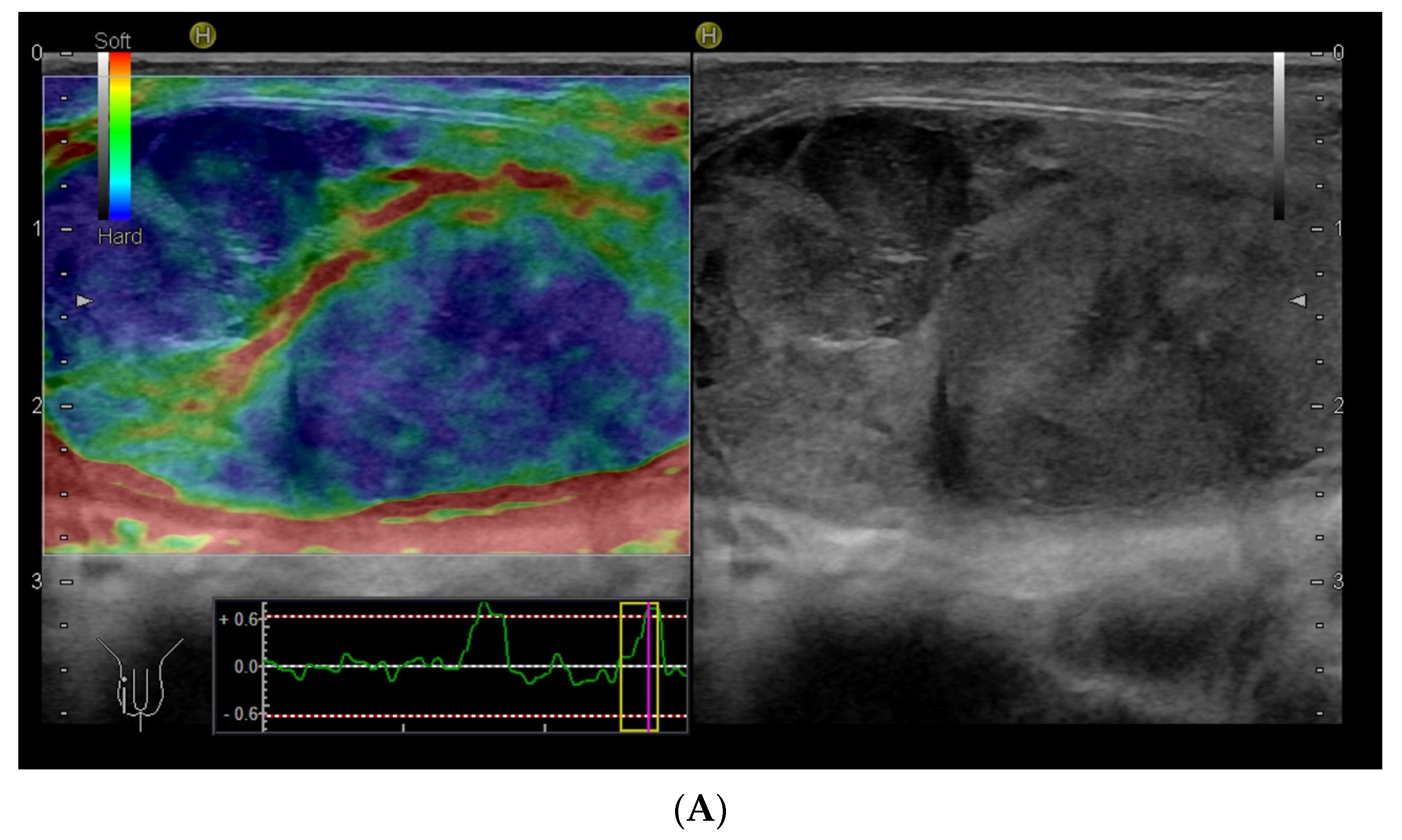 Diagnostics 14 01218 g006a Diagnostics 14 01218 g006a