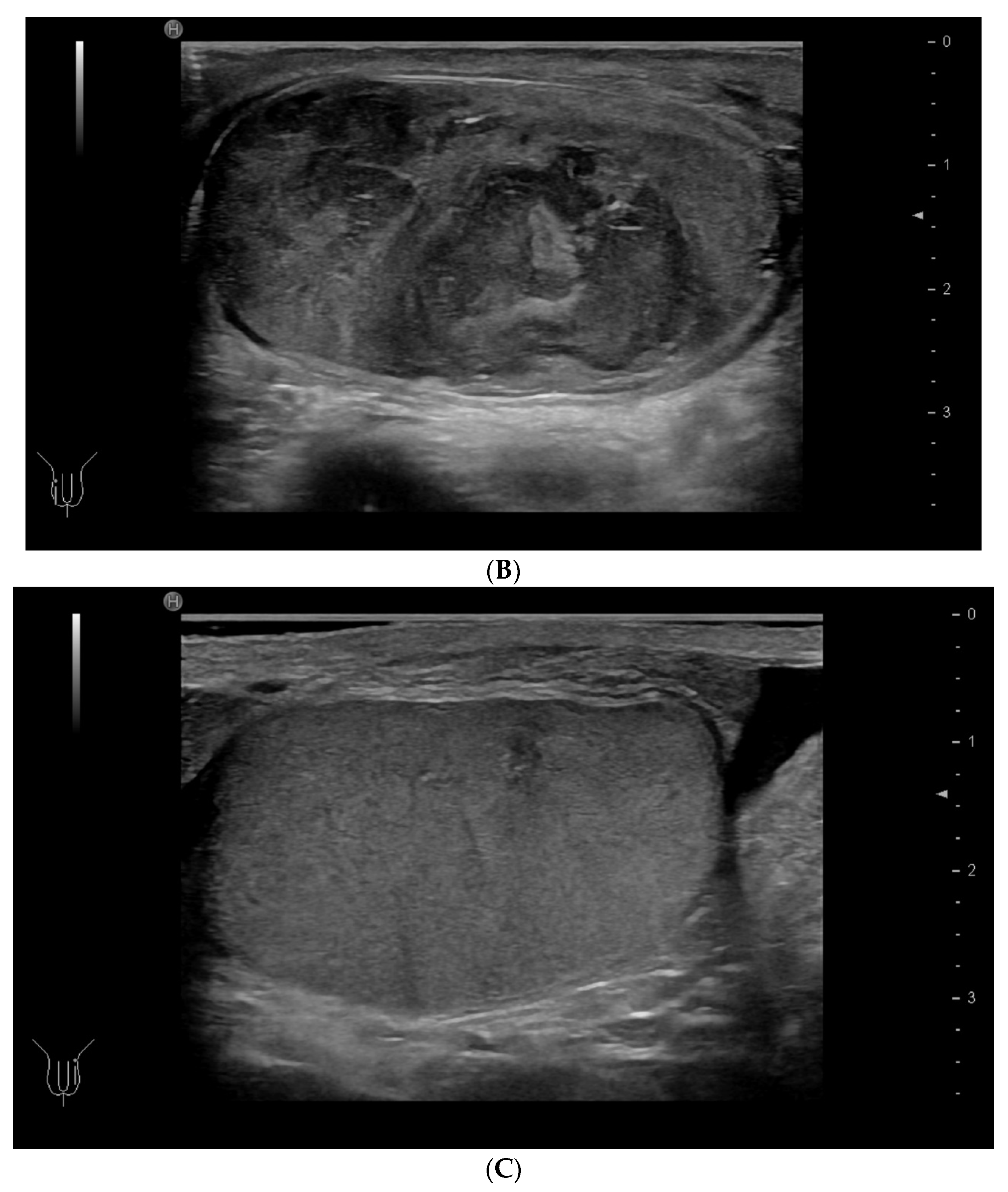 Diagnostics 14 01218 g006b Diagnostics 14 01218 g006b