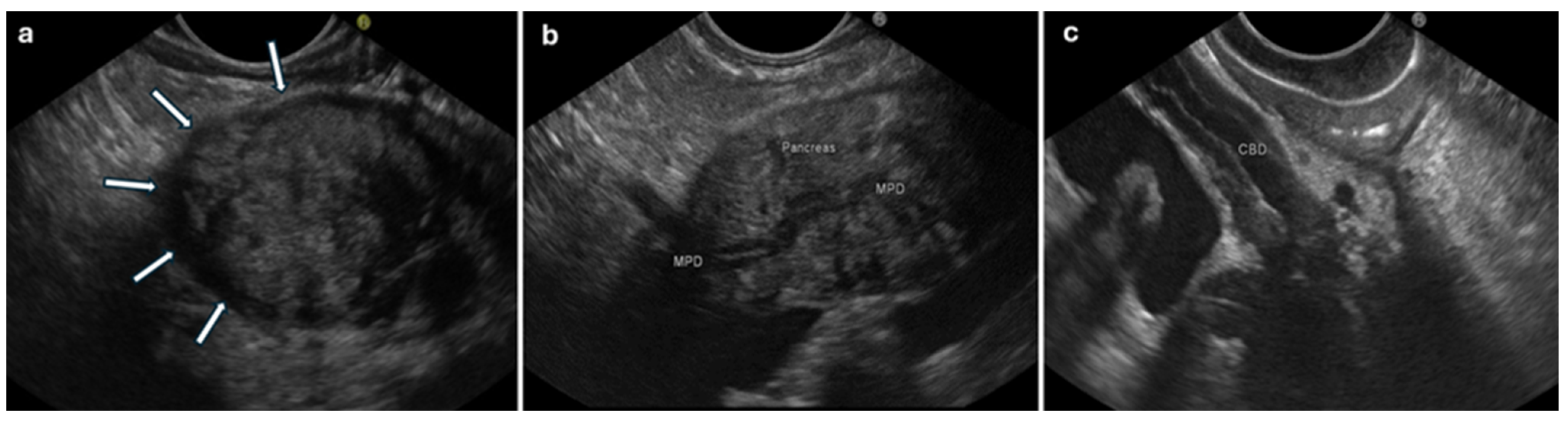 Diagnostics 14 01233 g001