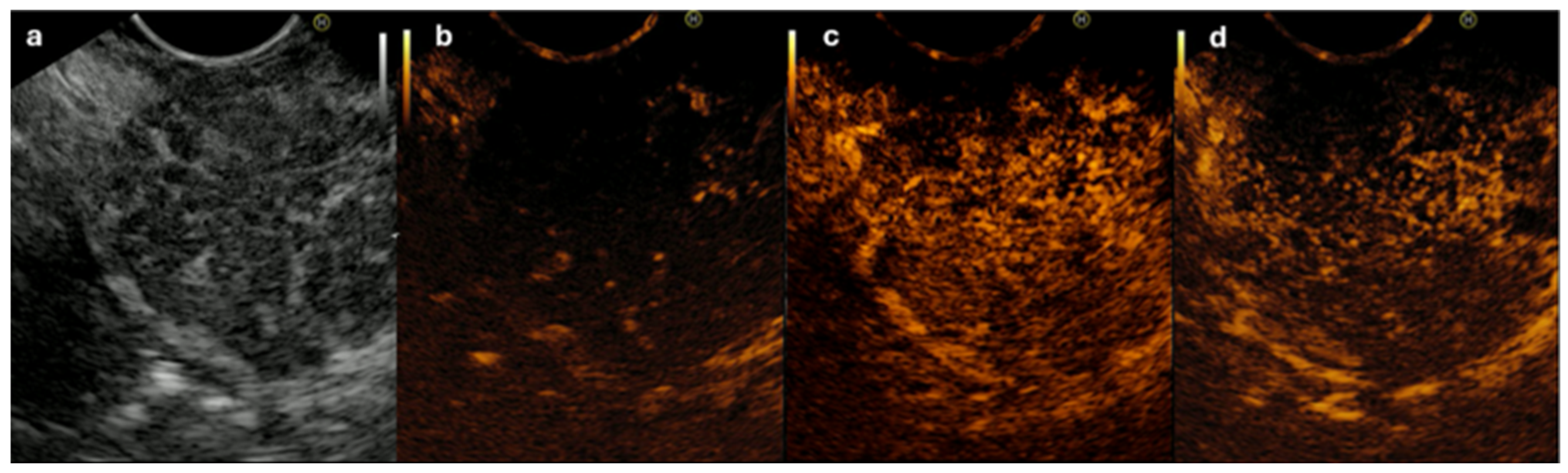 Diagnostics 14 01233 g002