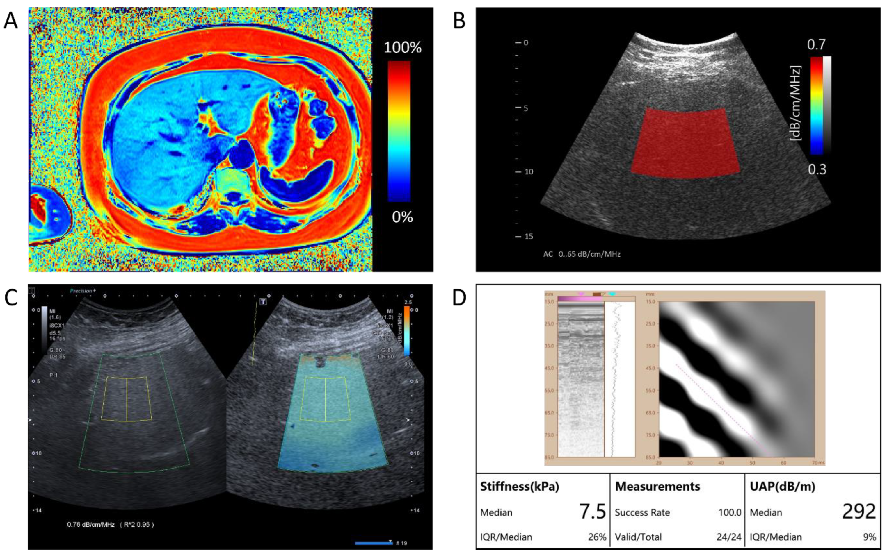 Diagnostics 14 01237 g002 Diagnostics 14 01237 g002