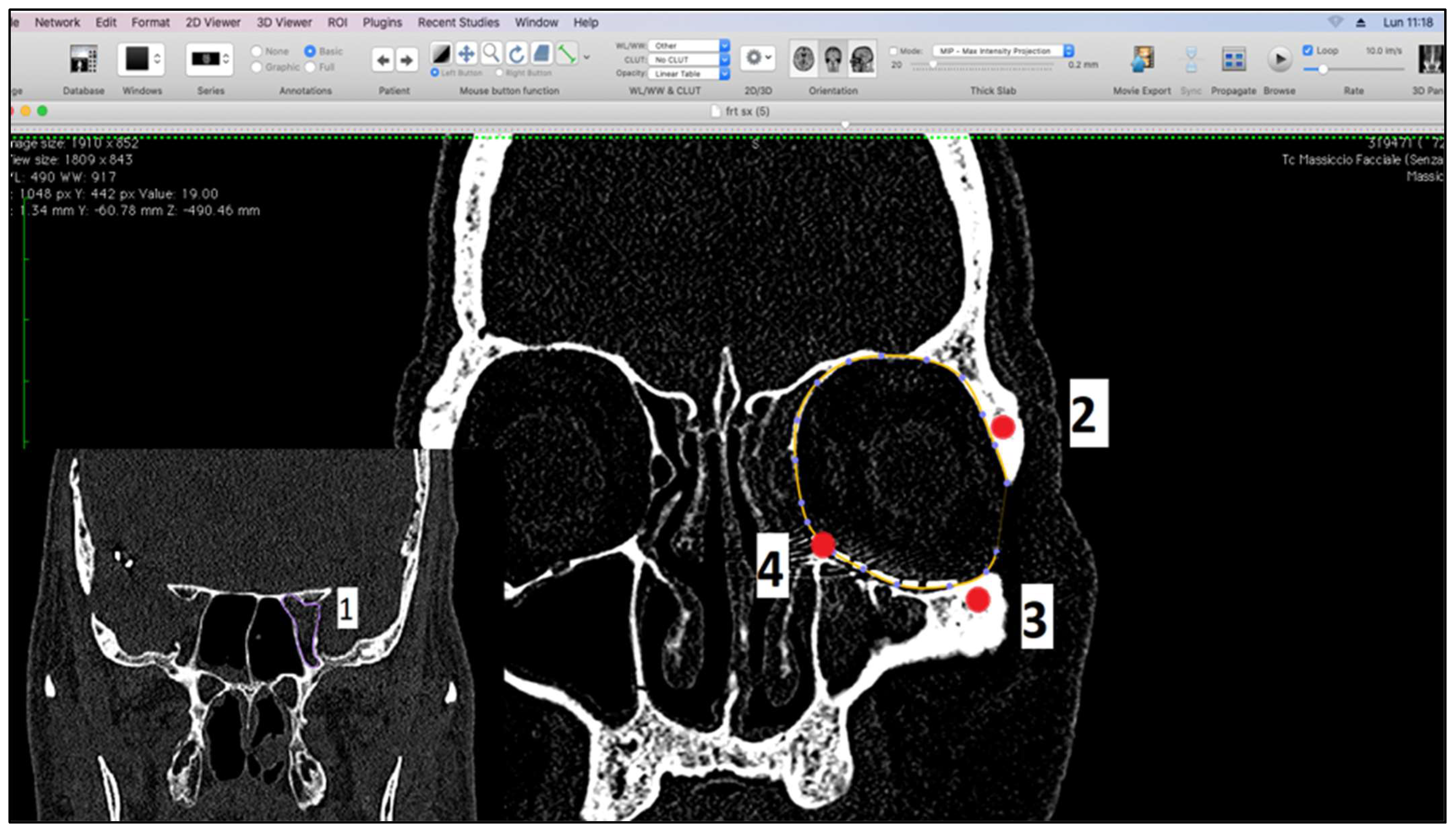 Diagnostics 14 01248 g001