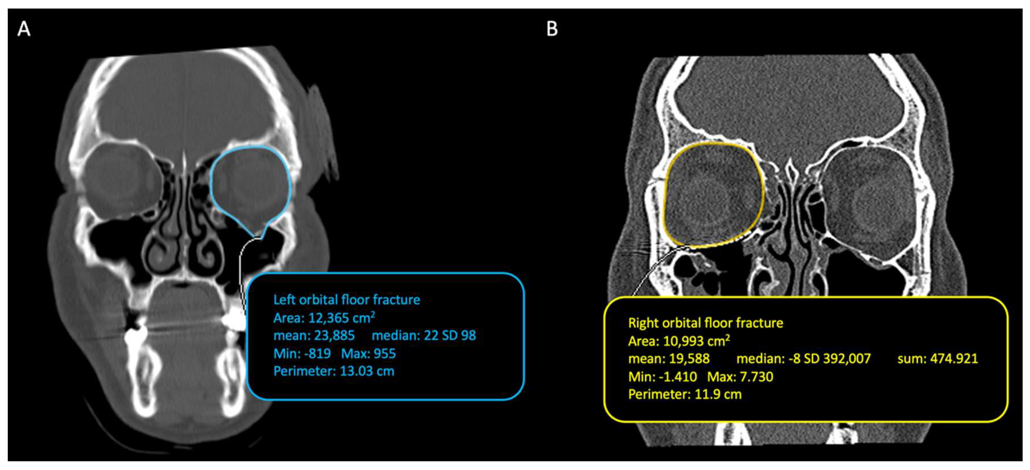 Diagnostics 14 01248 g002