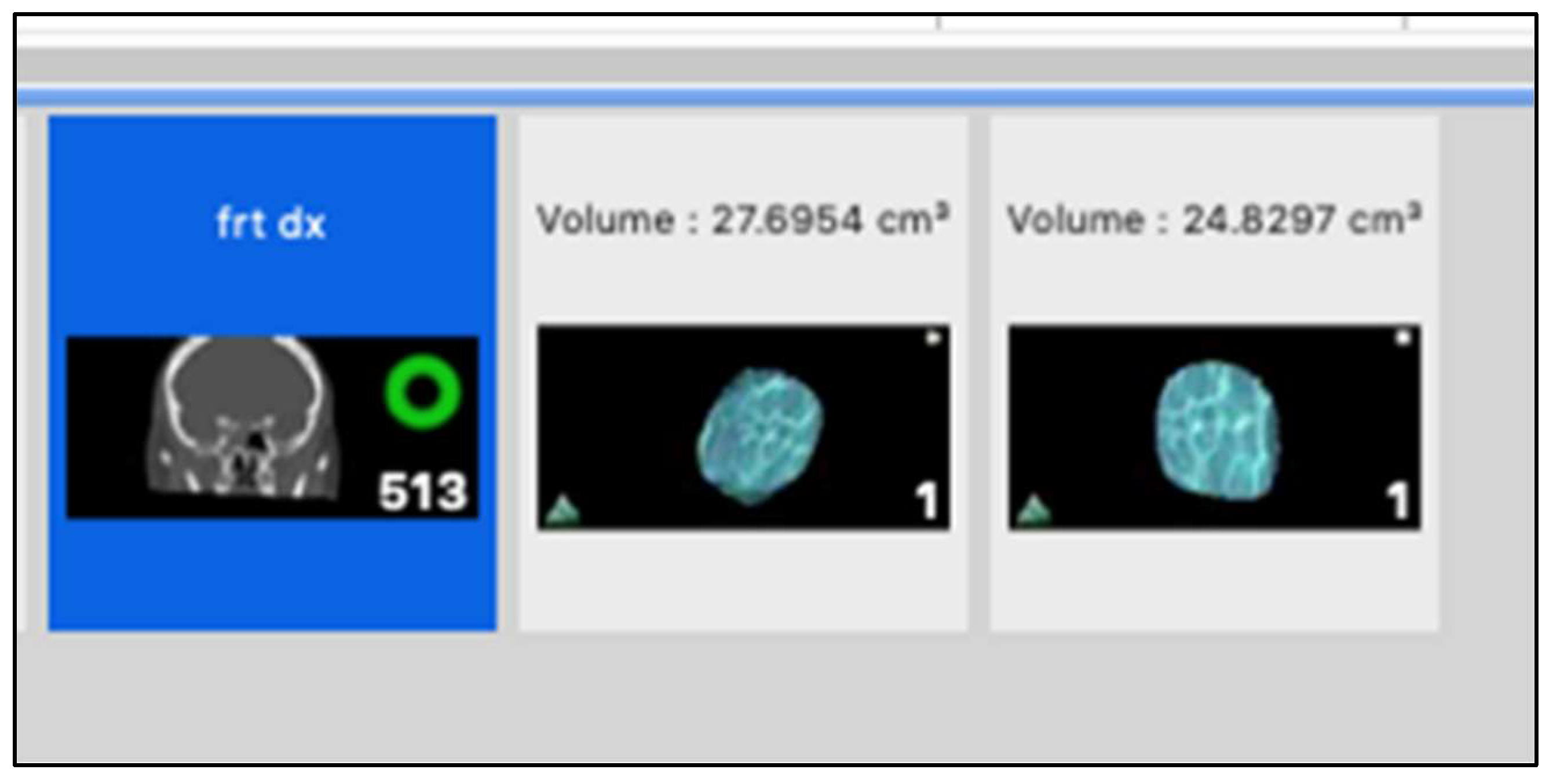 Diagnostics 14 01248 g003
