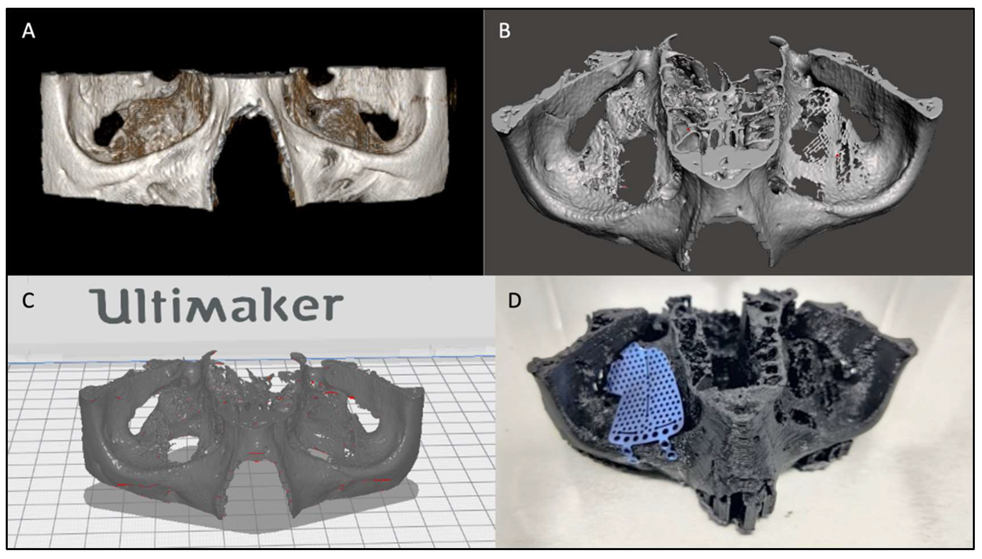 Diagnostics 14 01248 g004