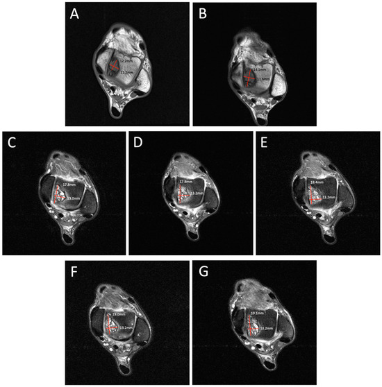 Diagnostics 14 01251 g001