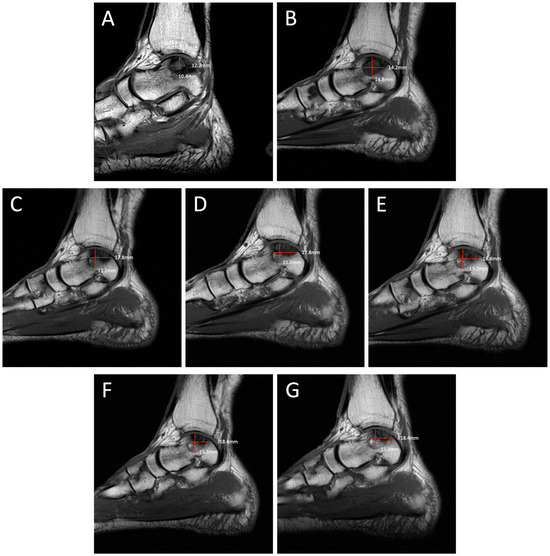 Diagnostics 14 01251 g003