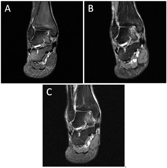 Diagnostics 14 01251 g005