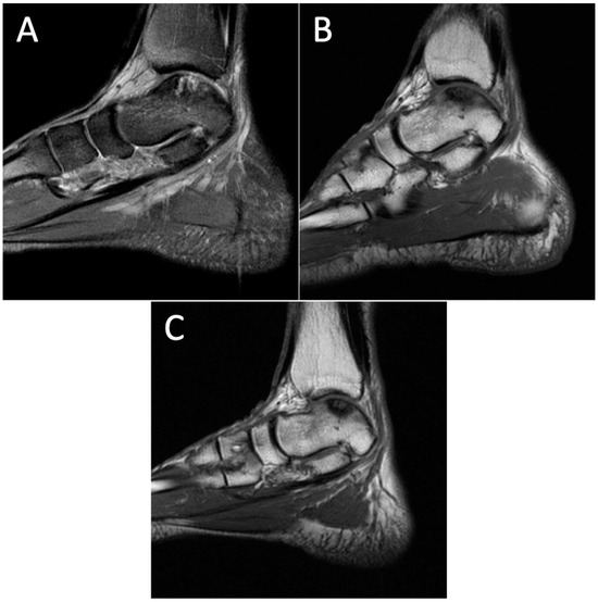 Diagnostics 14 01251 g006