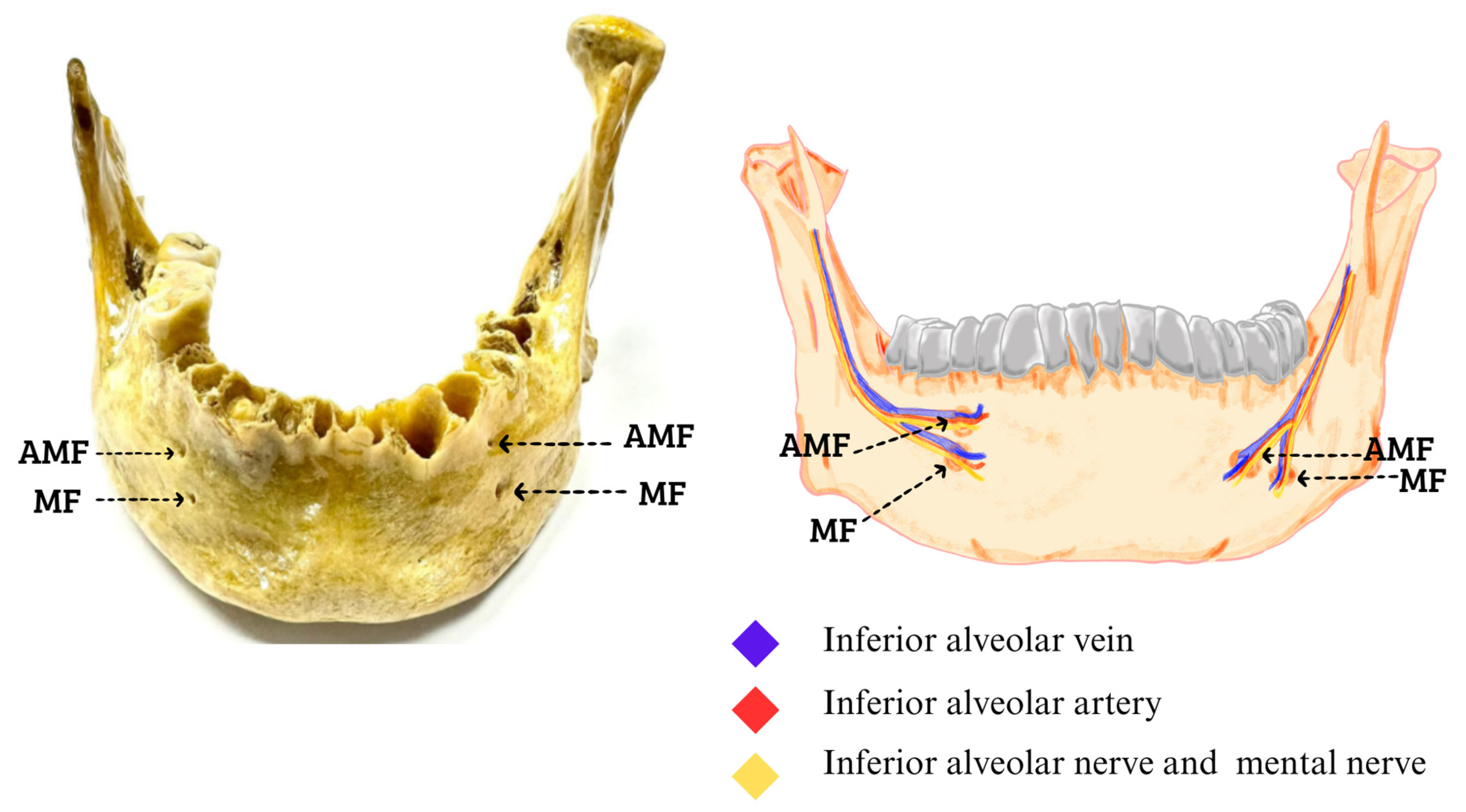 Diagnostics 14 01277 g001