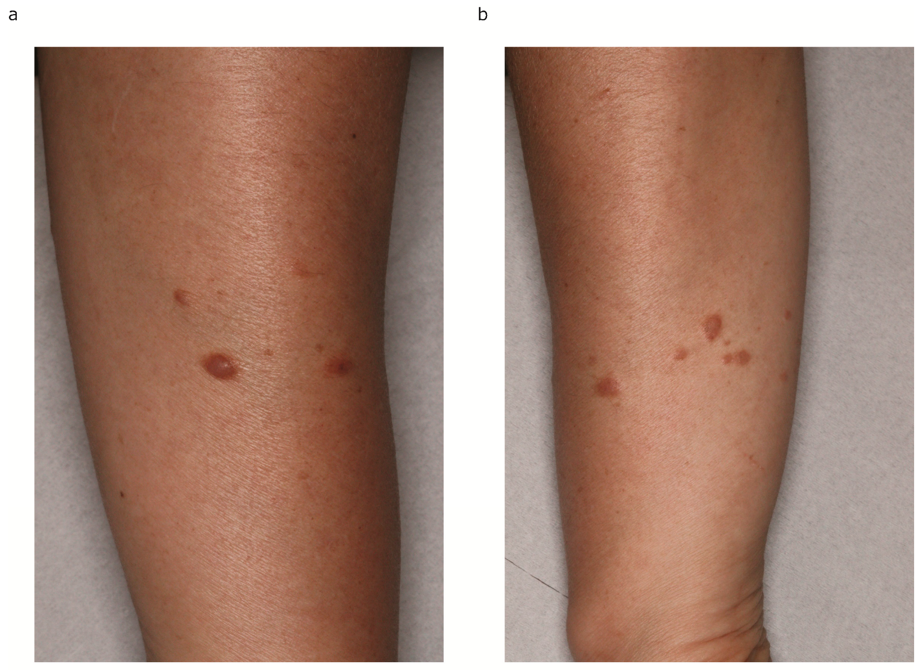 Diagnostics 14 01279 g001