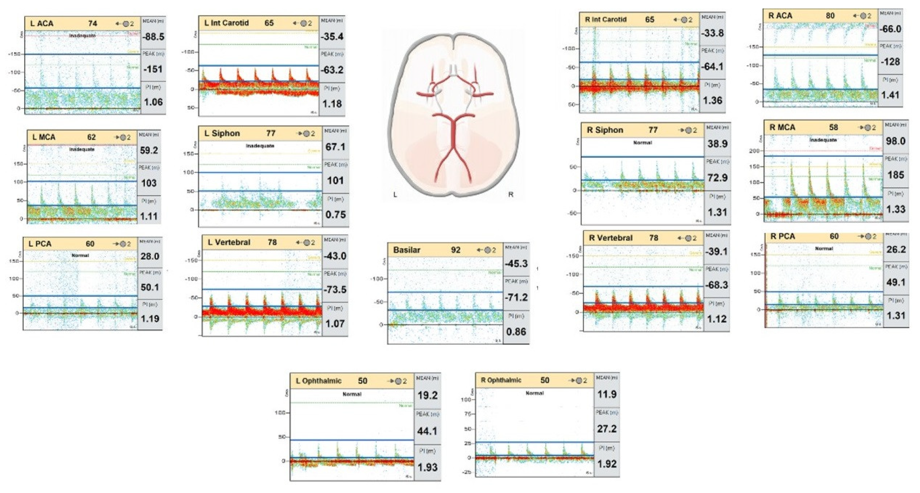 Diagnostics 14 01287 g006 Diagnostics 14 01287 g006