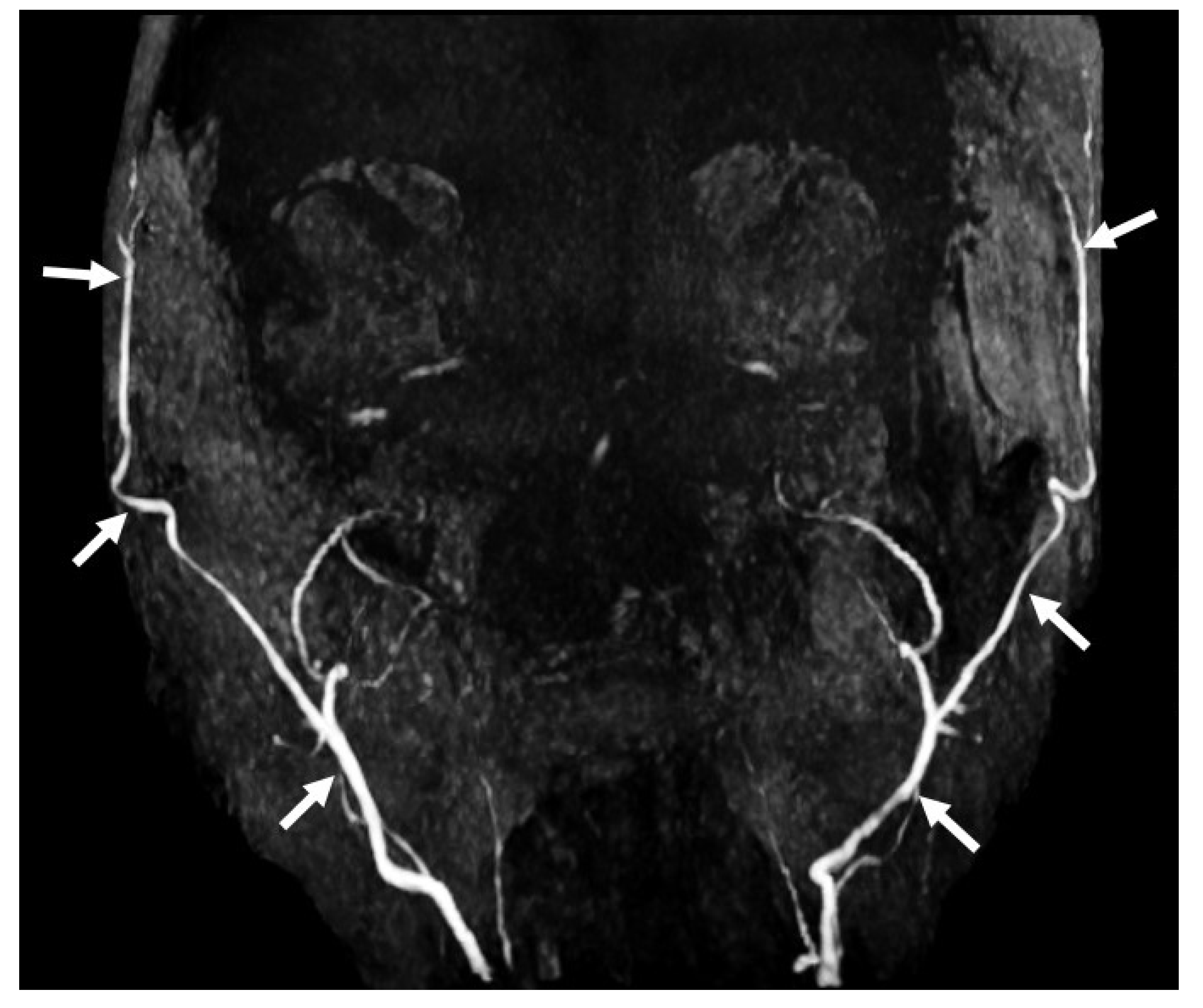 Diagnostics 14 01287 g012 Diagnostics 14 01287 g012
