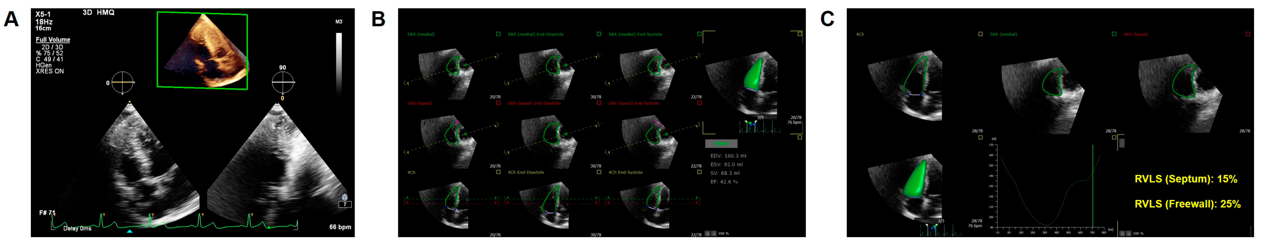 Diagnostics 14 01305 g002 Diagnostics 14 01305 g002