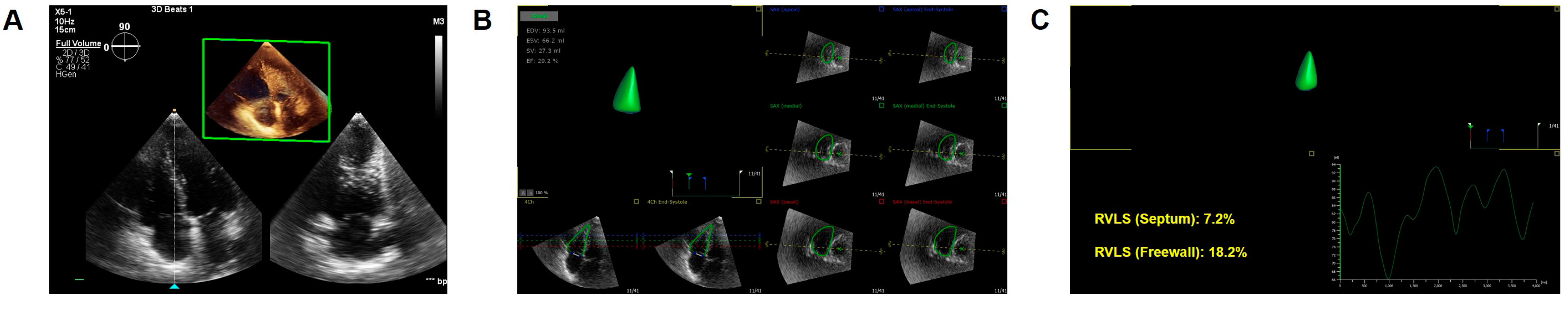 Diagnostics 14 01305 g004 Diagnostics 14 01305 g004