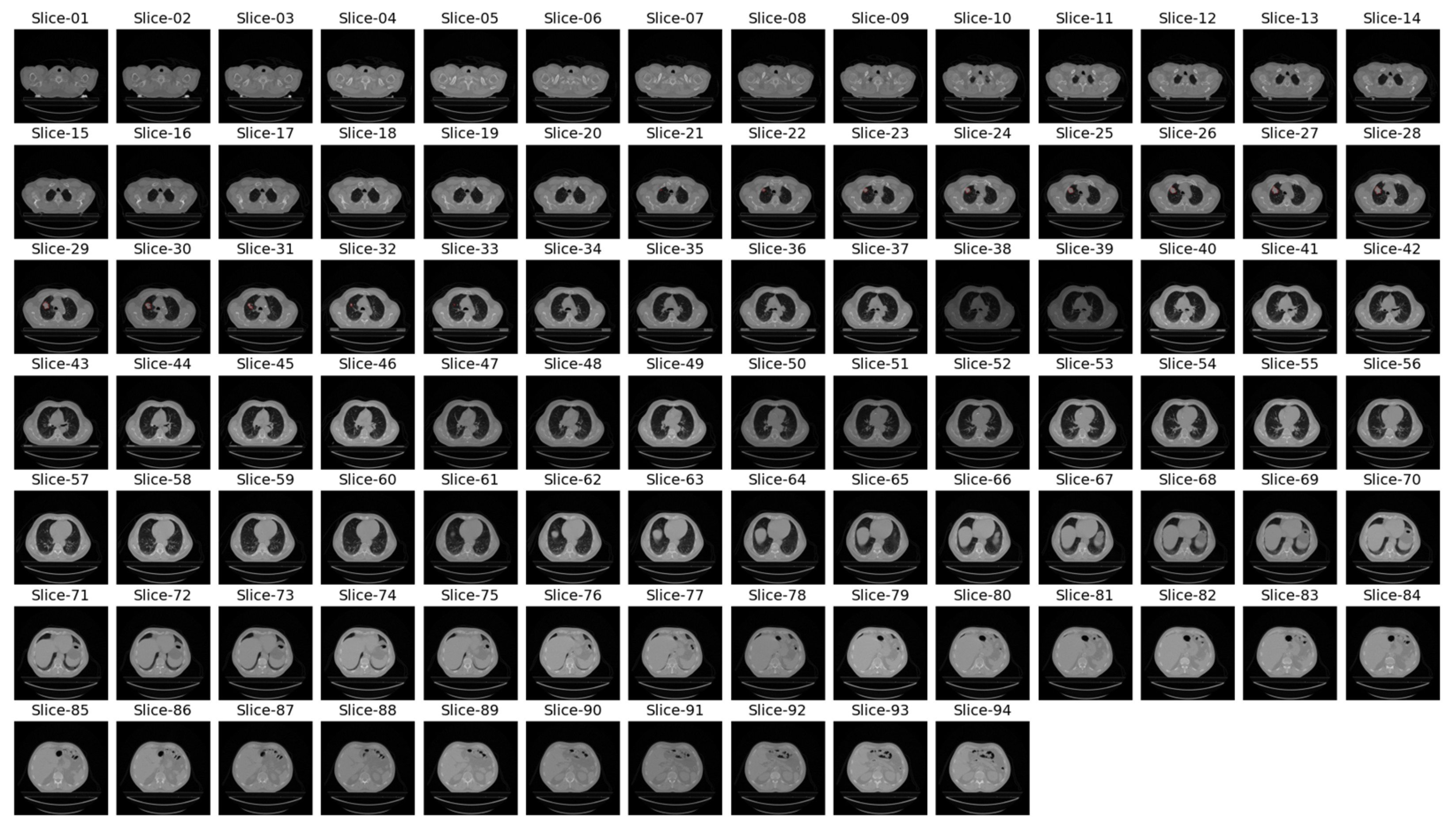 Diagnostics 14 01309 g004