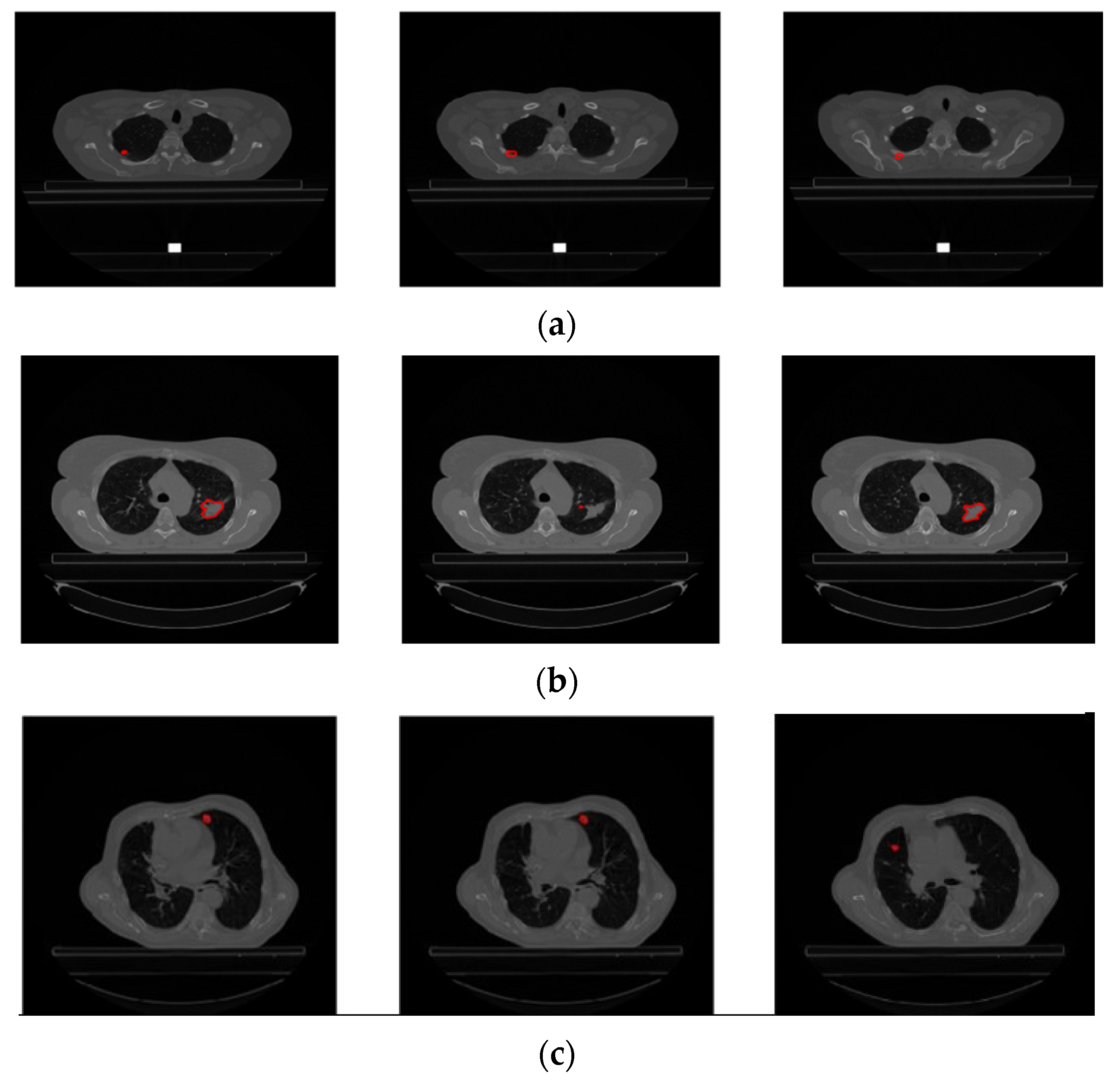 Diagnostics 14 01309 g005