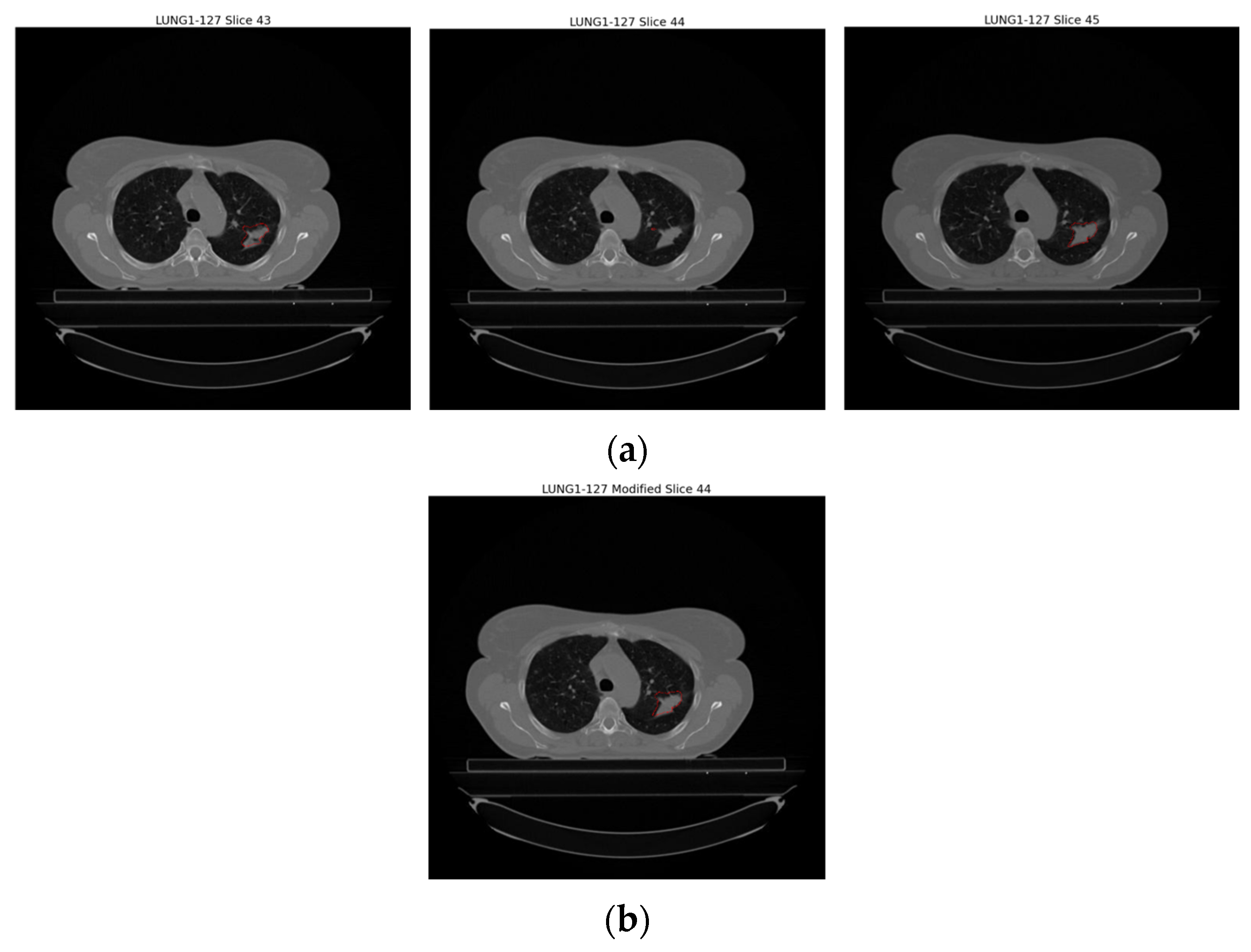 Diagnostics 14 01309 g006