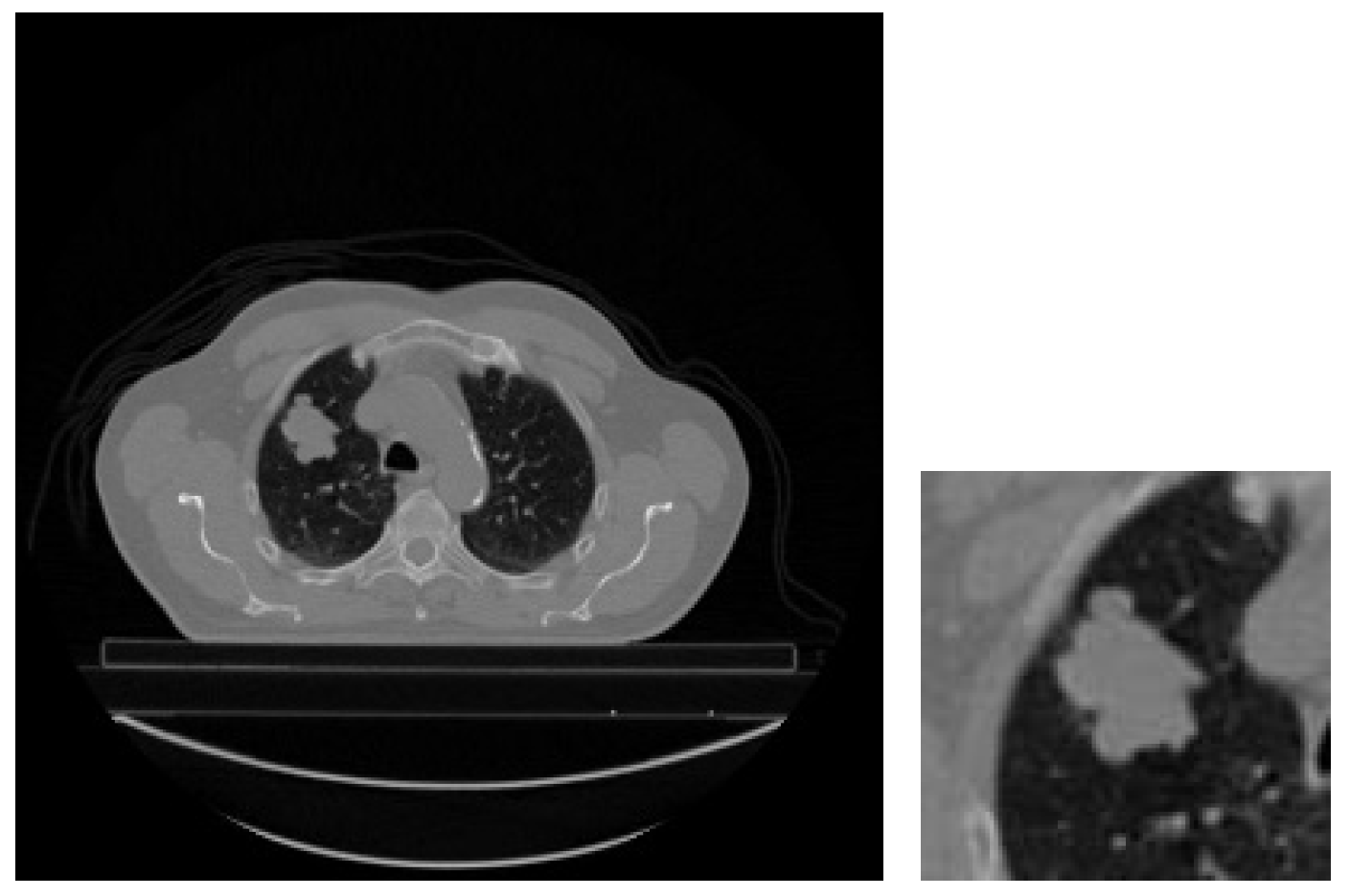 Diagnostics 14 01309 g011