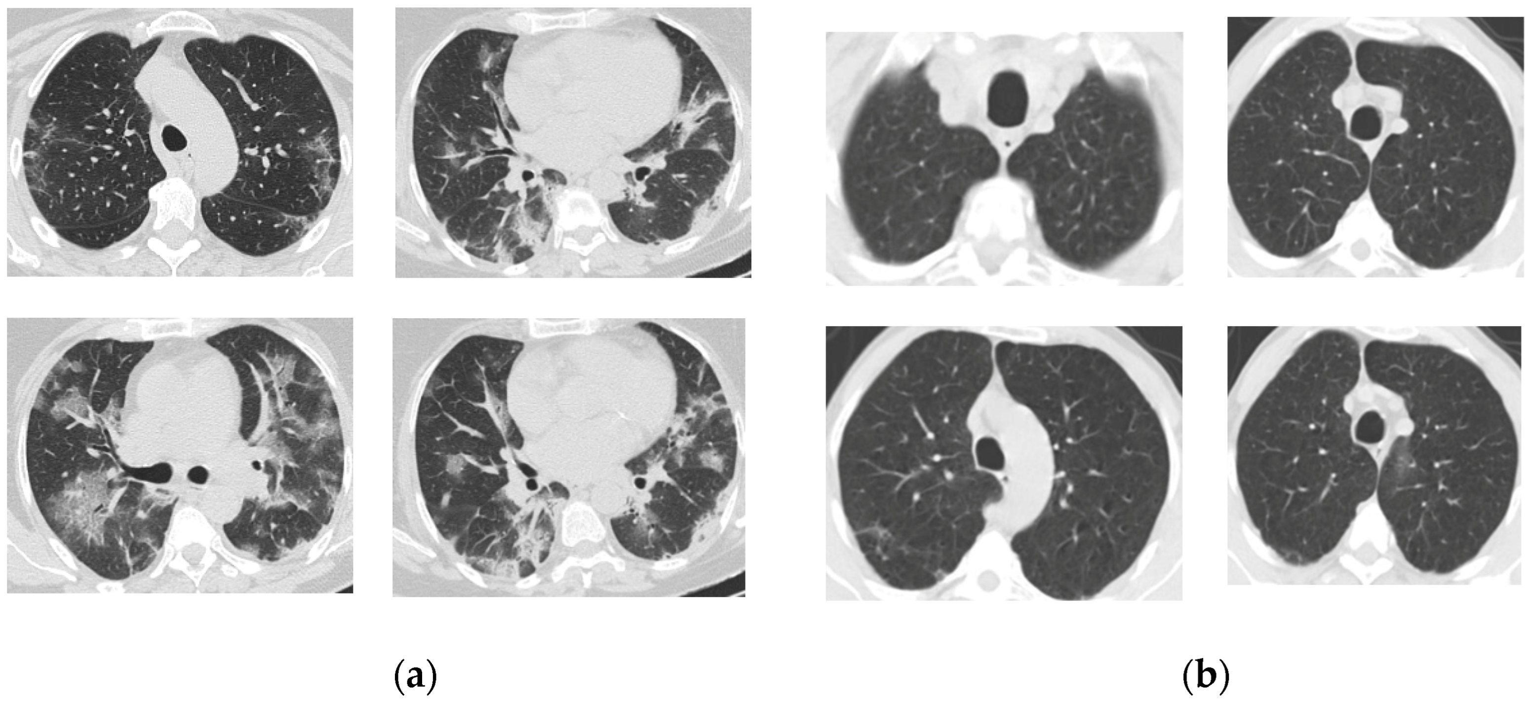 Diagnostics 14 01313 g001