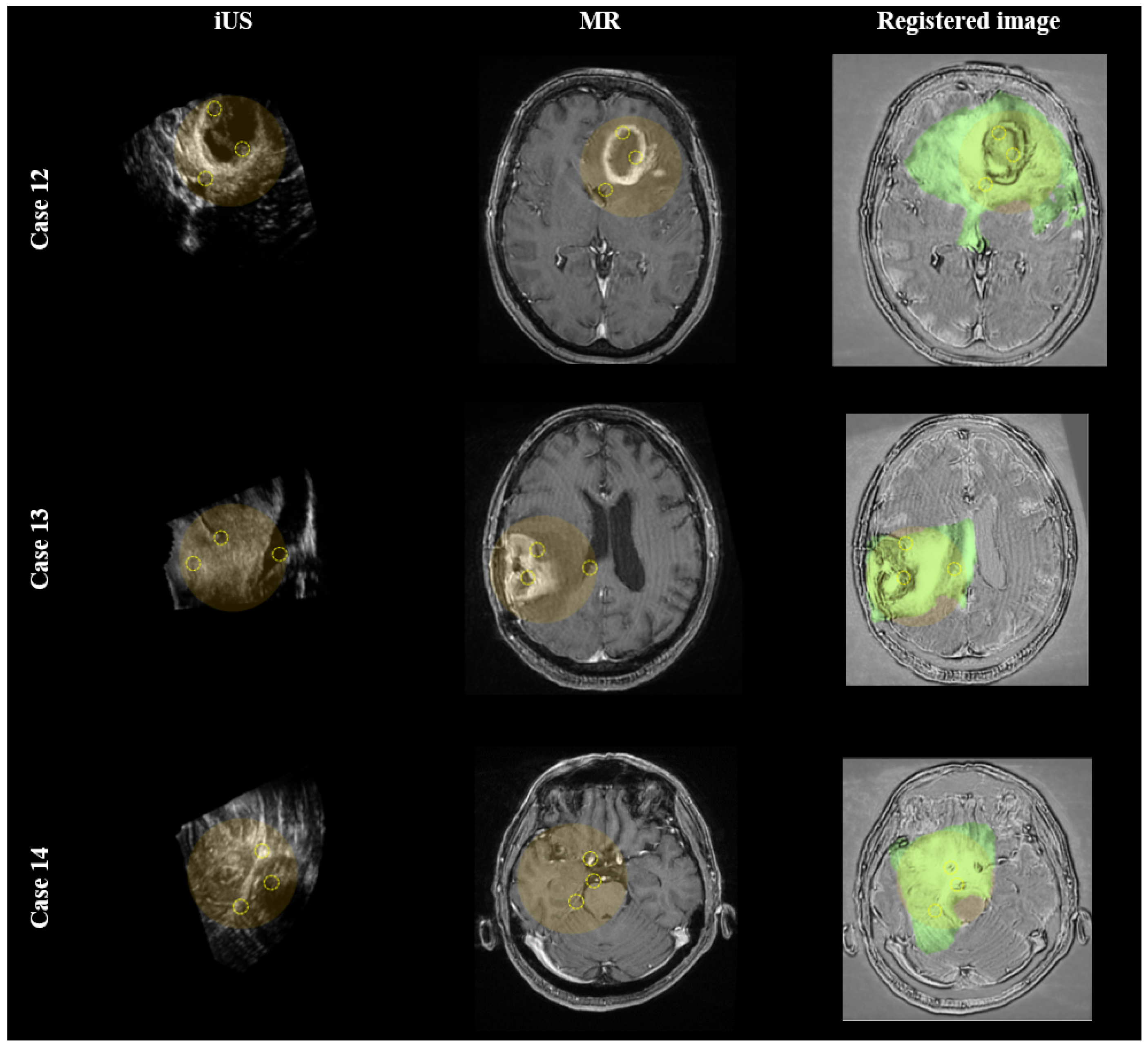 Diagnostics 14 01319 g004