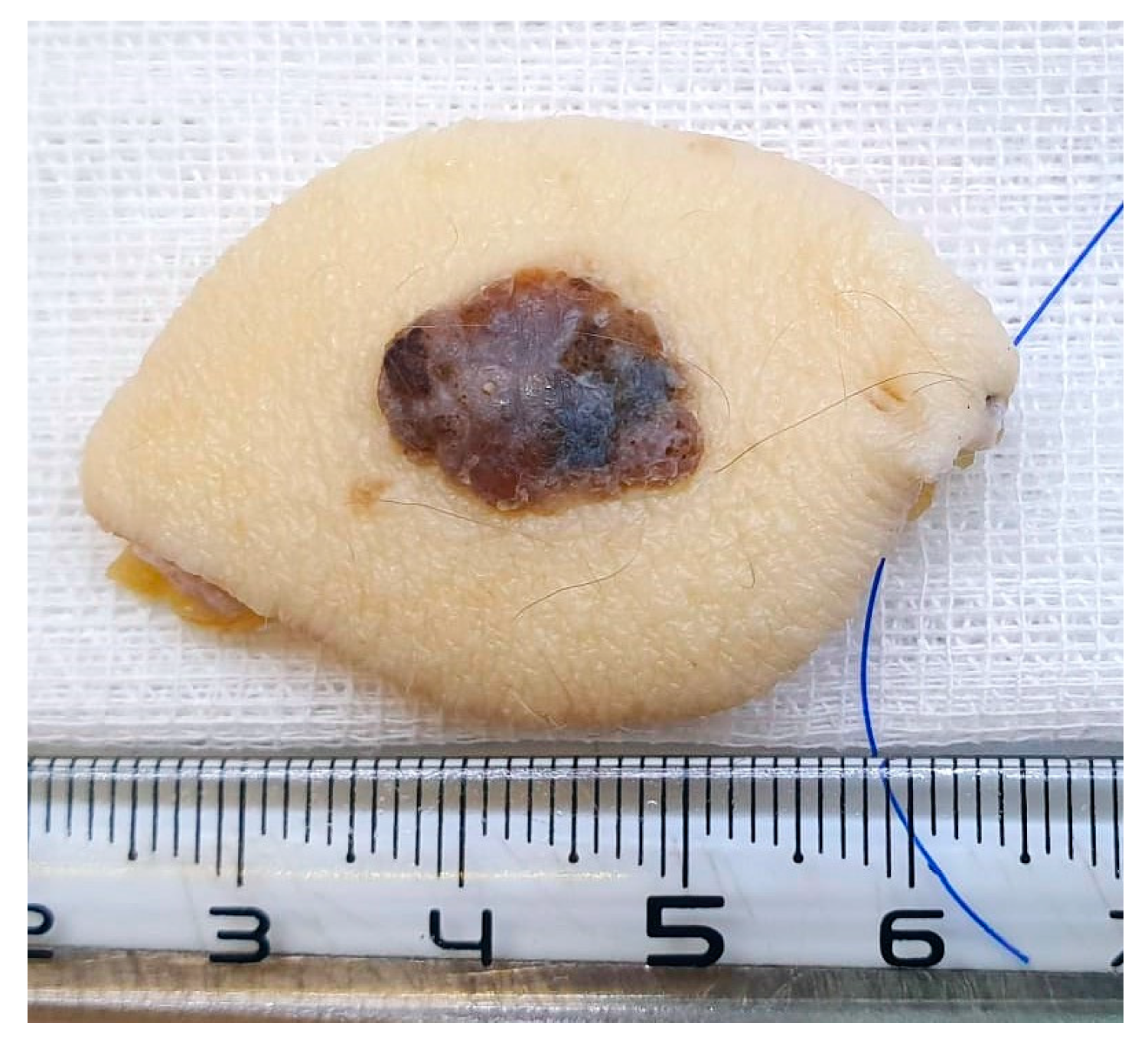 Diagnostics 14 01323 g001