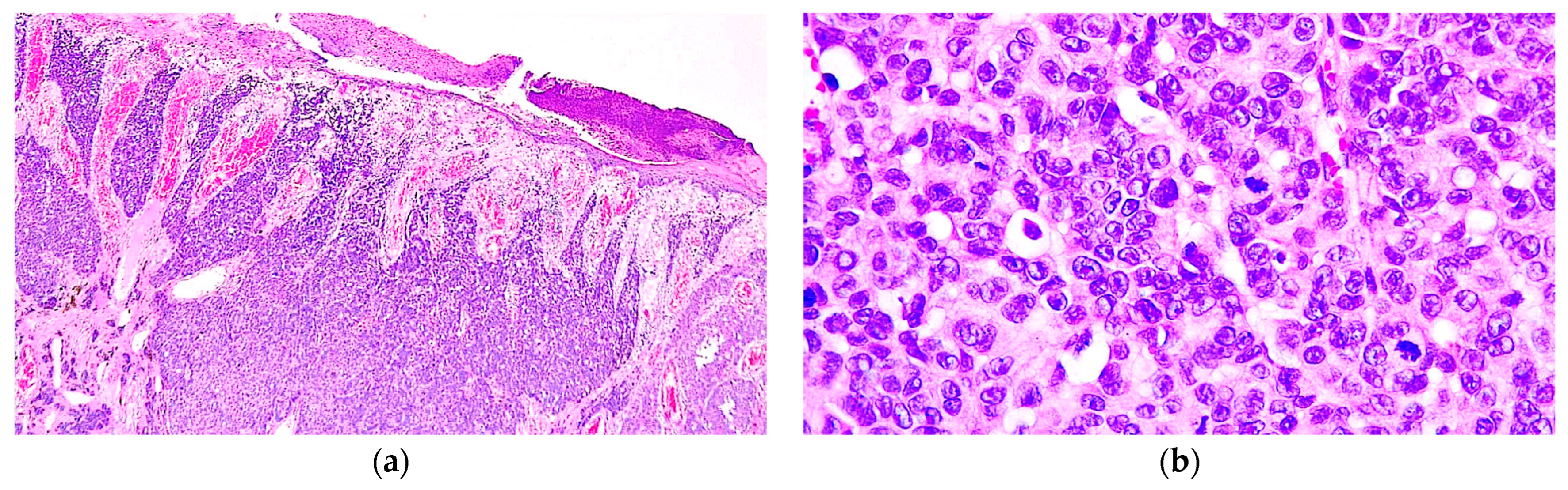 Diagnostics 14 01323 g002