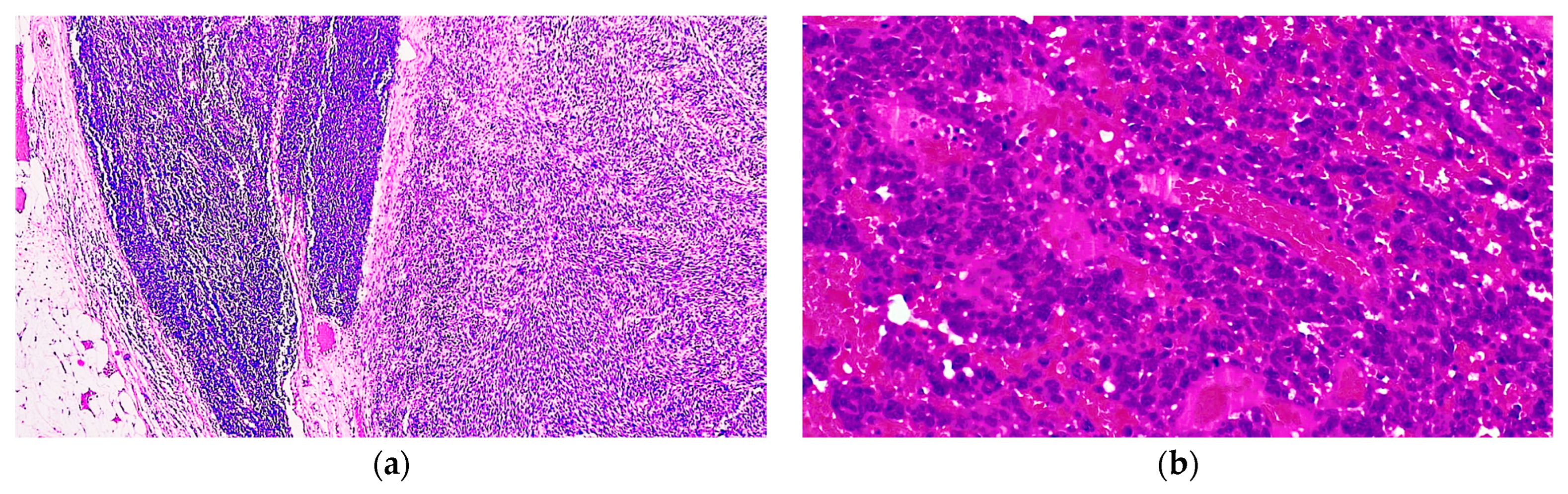 Diagnostics 14 01323 g004