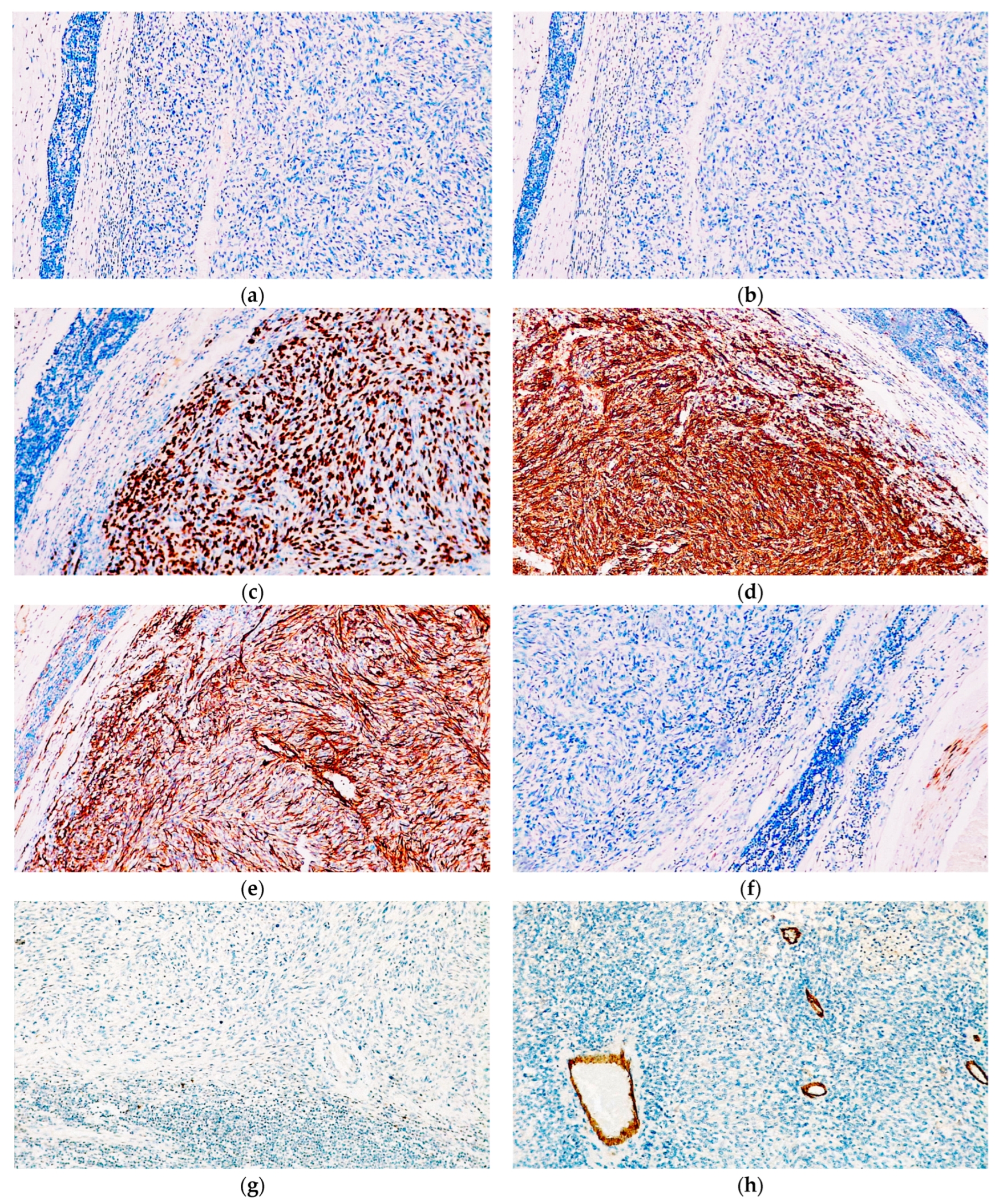 Diagnostics 14 01323 g005a
