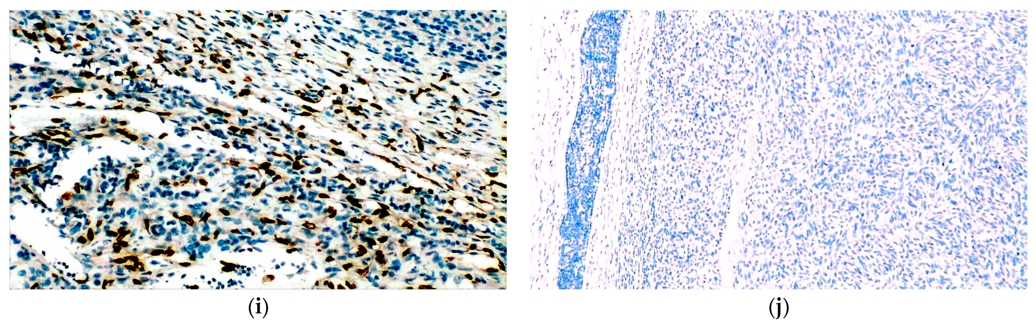 Diagnostics 14 01323 g005b